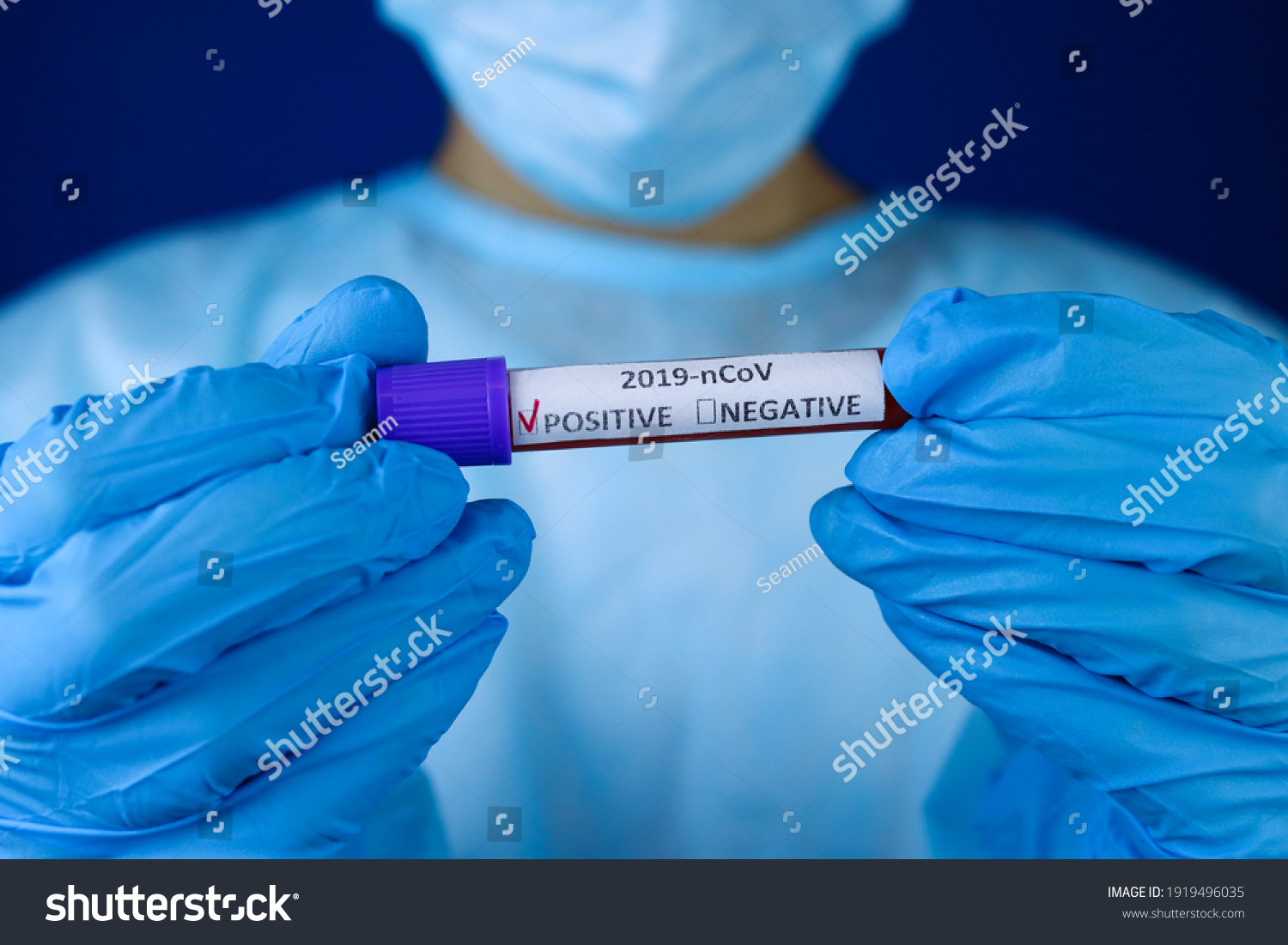 laboratory-sample-blood-positive-covid19-test-stock-photo-1919496035