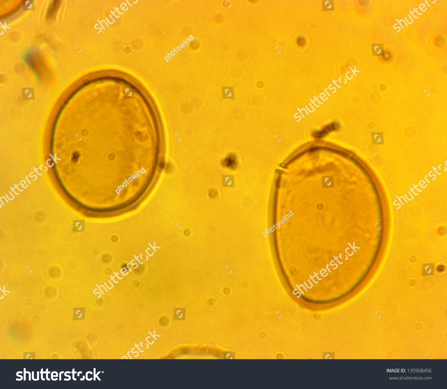 Lancet Liver Fluke Eggs Dicrocoelium Dendriticum Stock ...