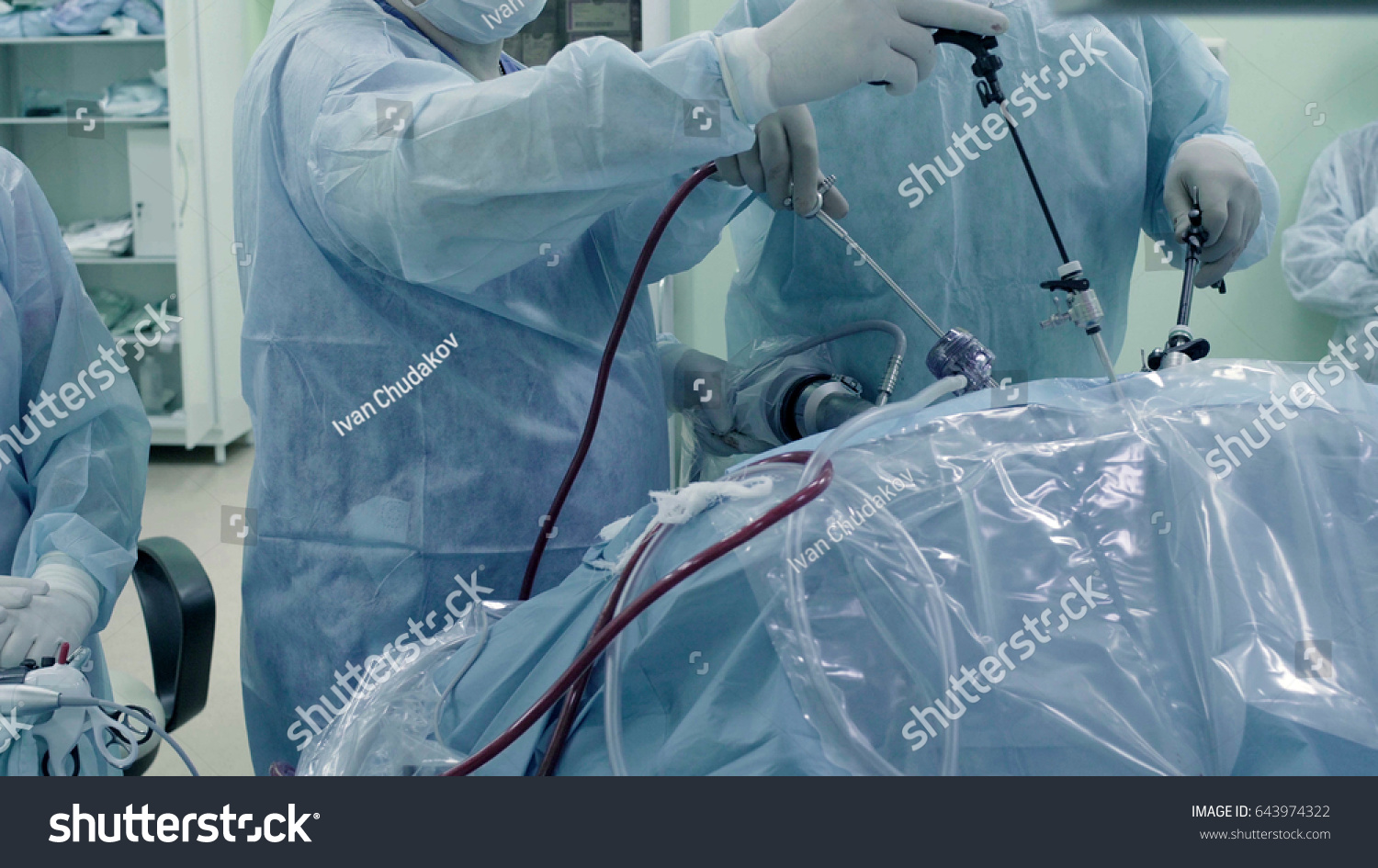 Laparoscopic Surgery Abdomen Team Medical Specialists Stock Photo ...