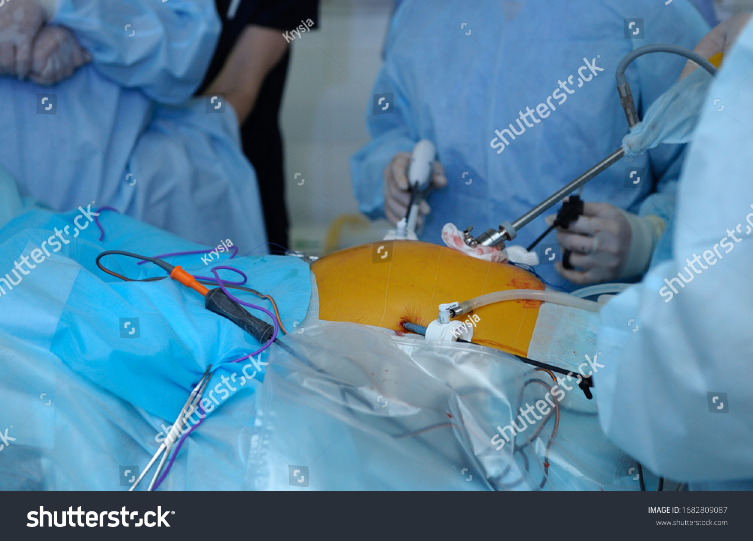 Laparoscopy Surgery Surgeon Hand Holding Laparoscopic Stock Photo ...