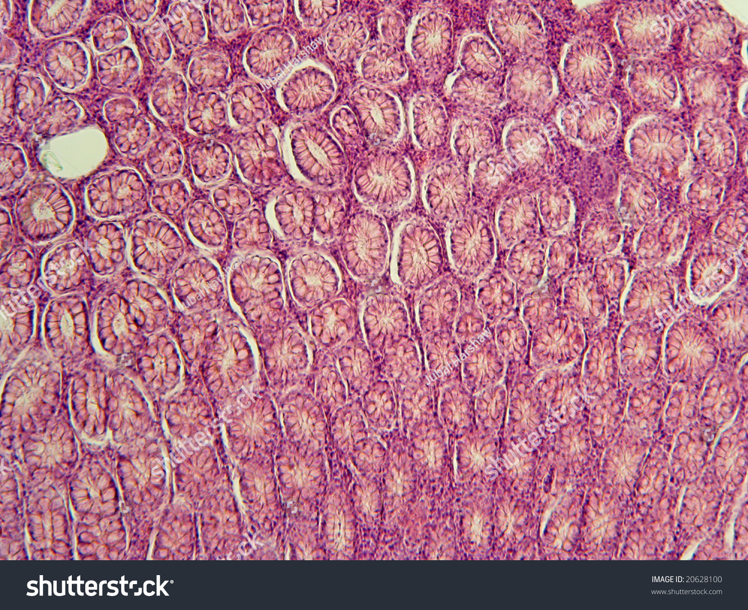 Large Intestine Villi Cross Sectioned Showing Goblet Cells_100x_cs0187 ...