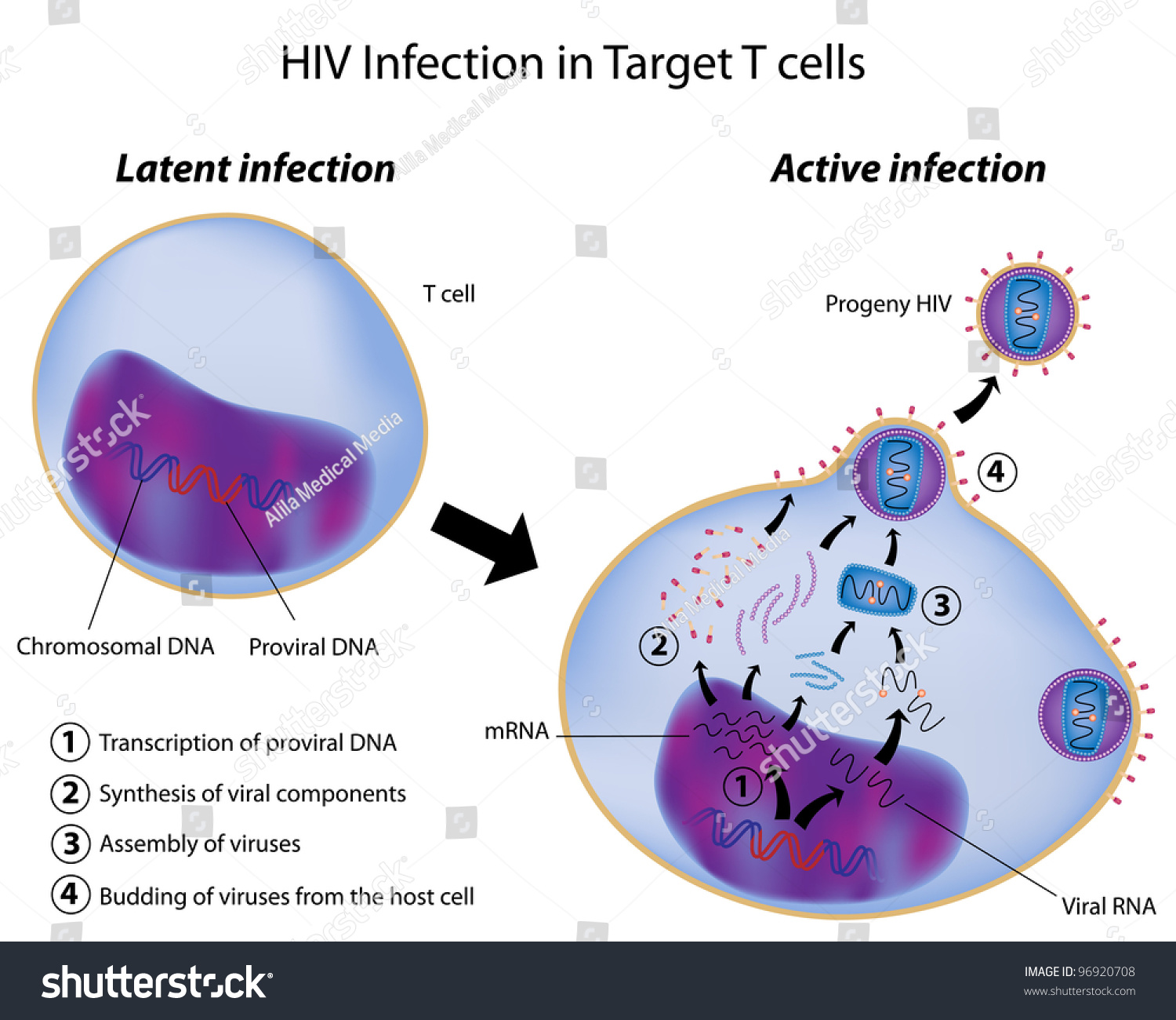 Latent And Active Infection Of T Cell By Hiv Stock Photo 96920708 ...