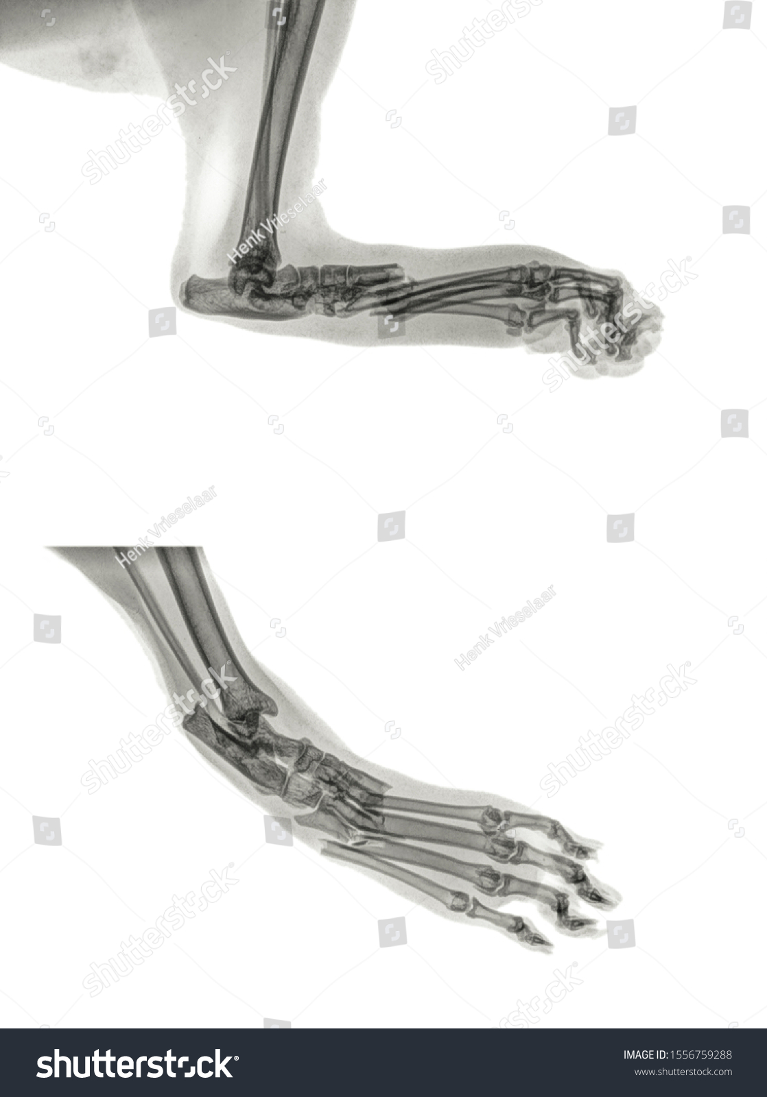 Lateral Dorsal Digital Xray Cat Fracture Stock Photo Edit Now 1556759288