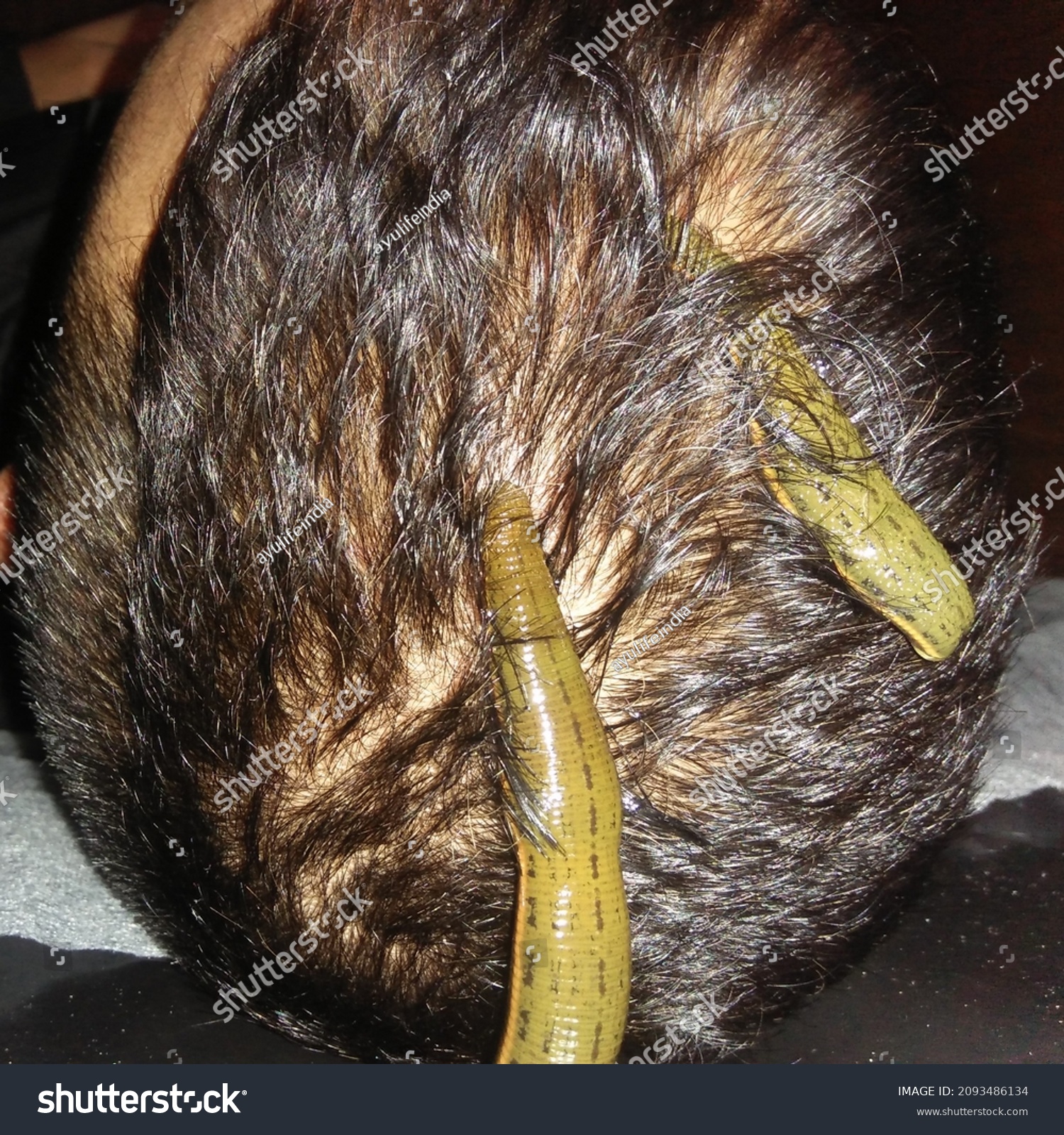 Leech Therapy Ayurveda Panchkarma Stock Photo 2093486134 | Shutterstock