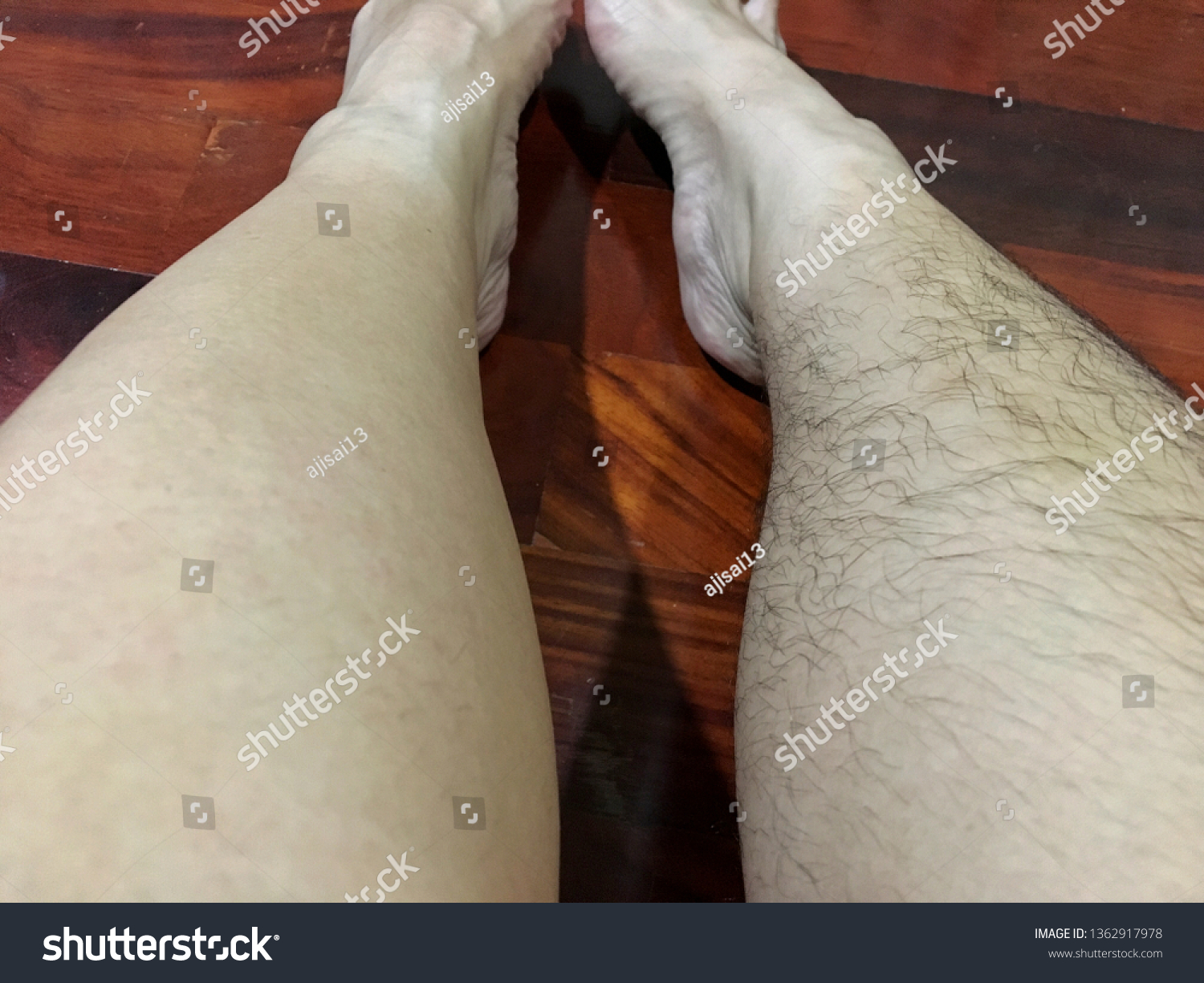 Hairy women legs pics