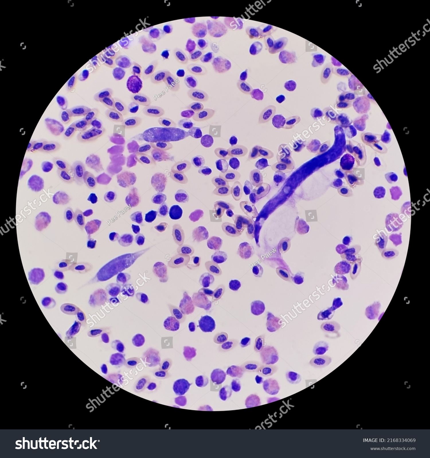 Leucocytozoon Spp Microfilaria Stained Blood Smear Stock Photo ...