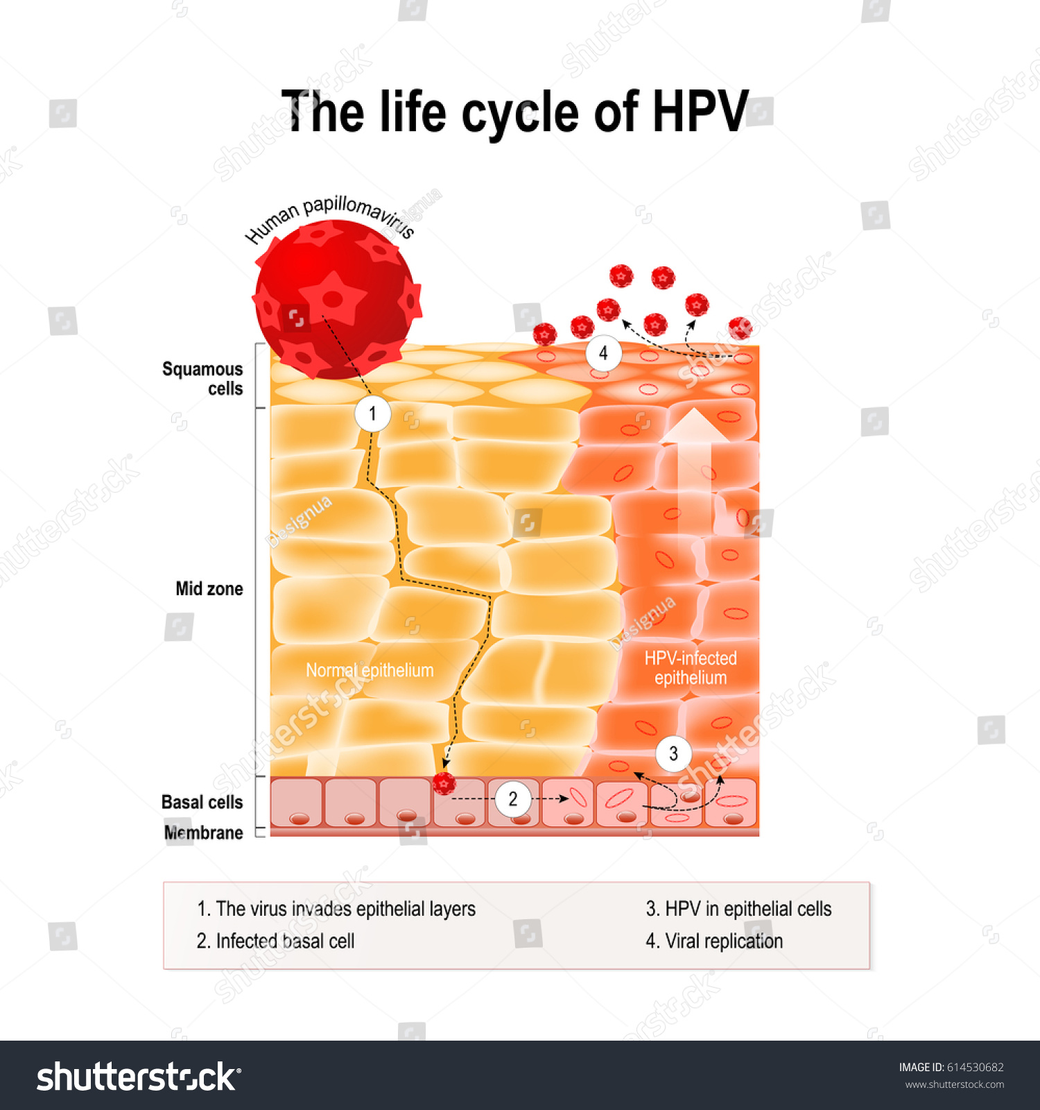 ilustrasi-stok-life-cycle-hpv-human-epithelium-hpv-614530682-shutterstock