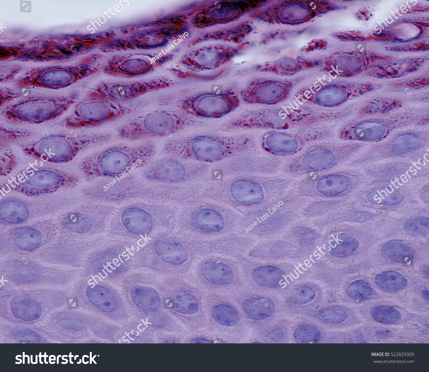 Light Micrograph Showing Stratum Spinosum Bottom Stock Photo 522829309 ...