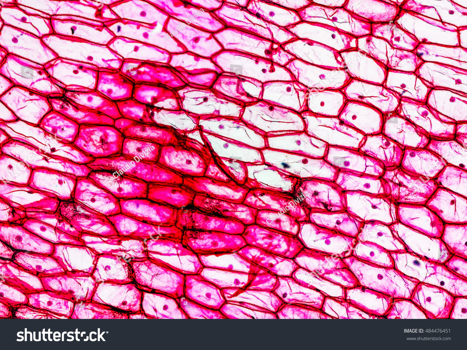 Light Photomicrograph Of An Onion Epidermus Cells Seen Through A ...