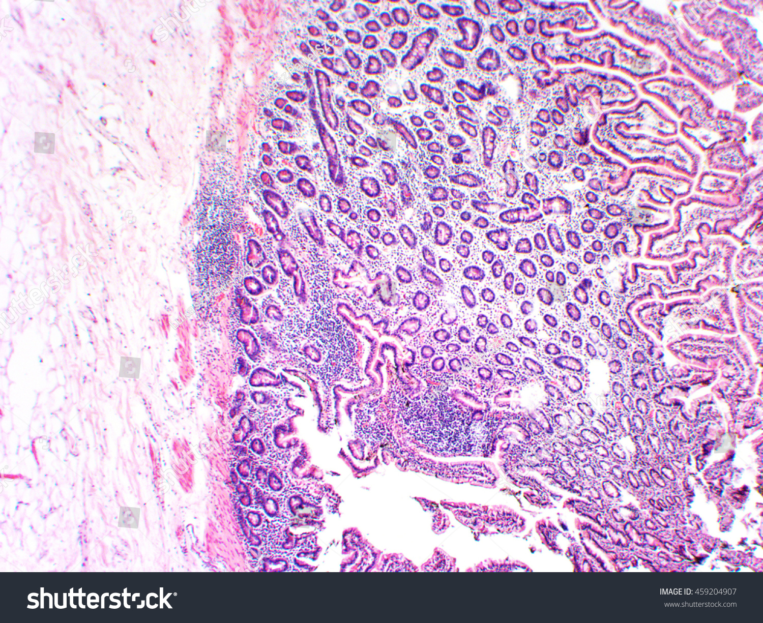 Lipoma Microscopic View Magnify X40 Stock Photo 459204907 - Shutterstock