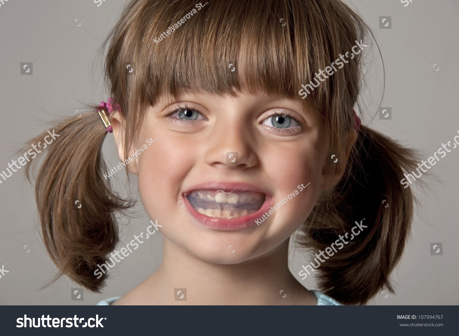 Little Girl Plastic Braces Stock Photo 107994767 - Shutterstock