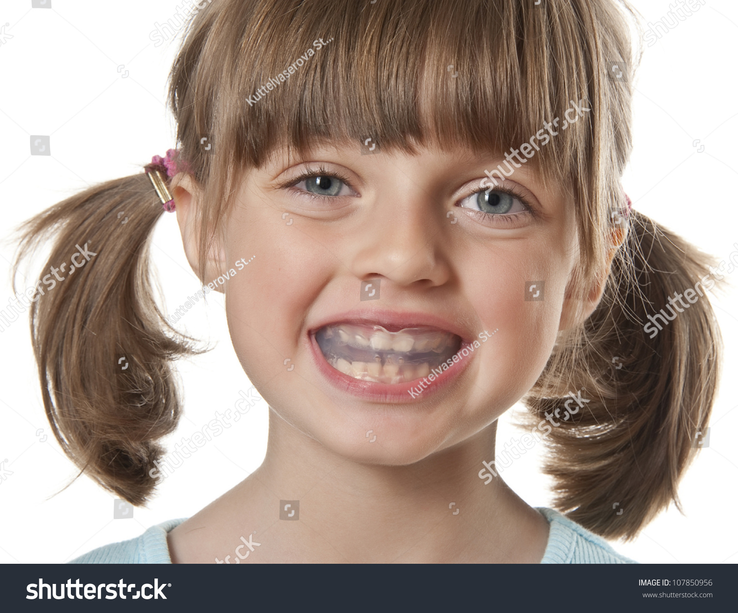 Little Girl With Plastic Braces Isolated On White Stock Photo 107850956 ...