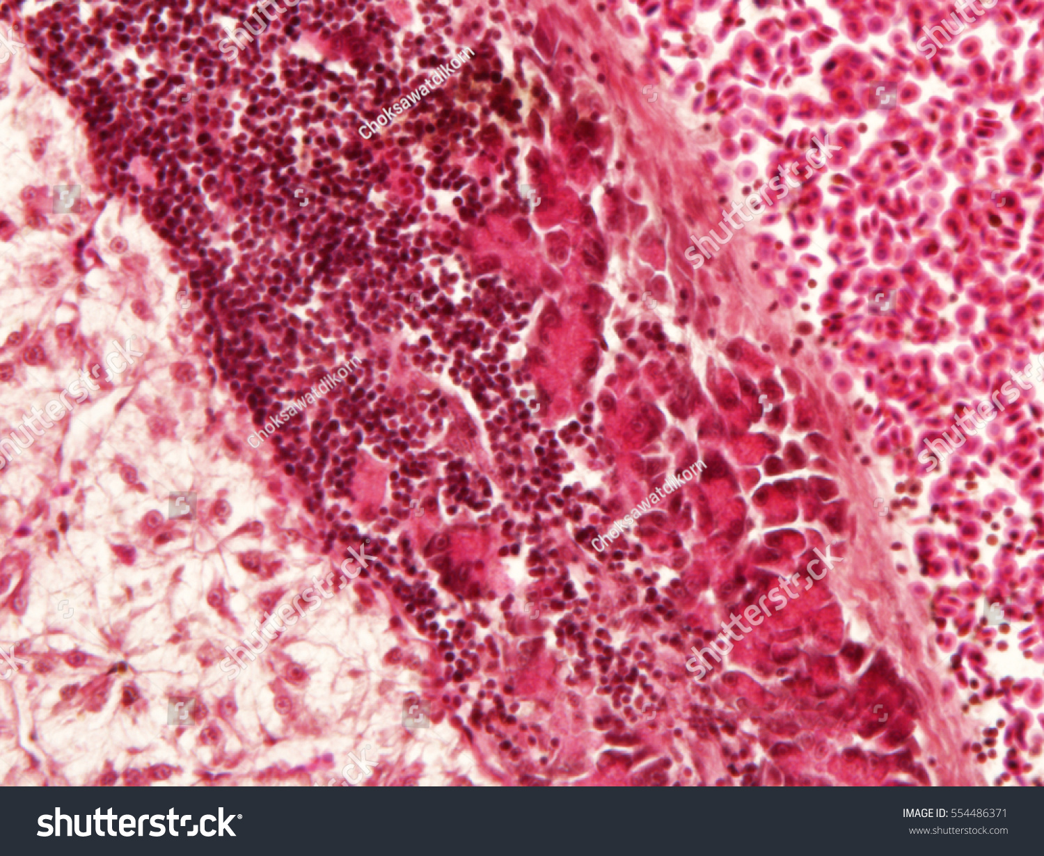 Liver Animal Tissue Under Microscope View Stock Photo 554486371 ...