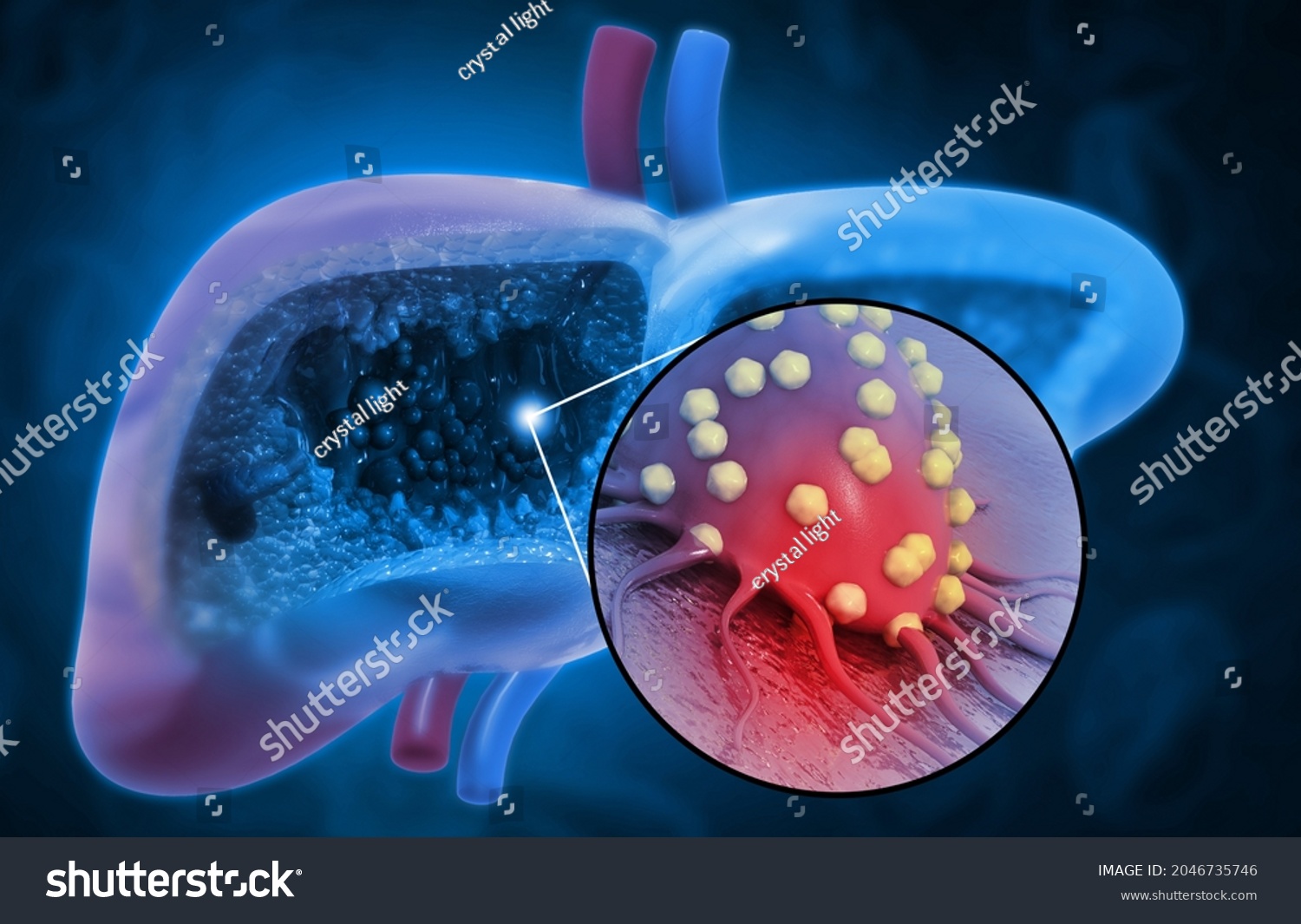 Liver Disease Liver Infection Viral Infection Stock Illustration