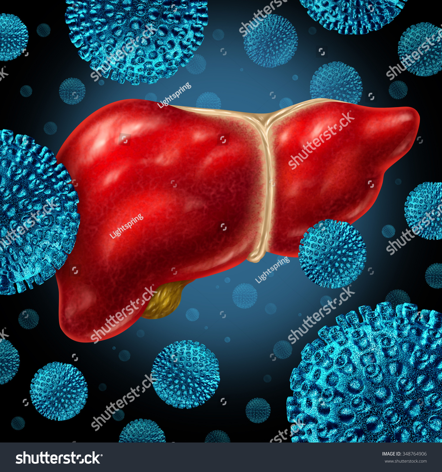 Liver Infection As A Human Liver Infected By The Hepatitis Virus As A ...