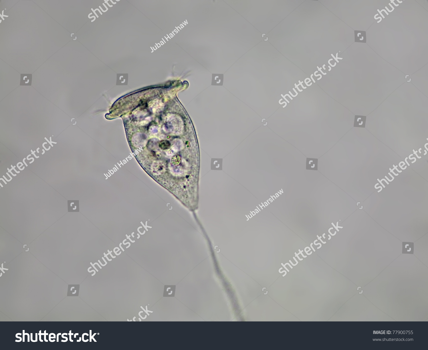 Living Vorticella Protozoan Fresh Water Magnification Stock Photo ...