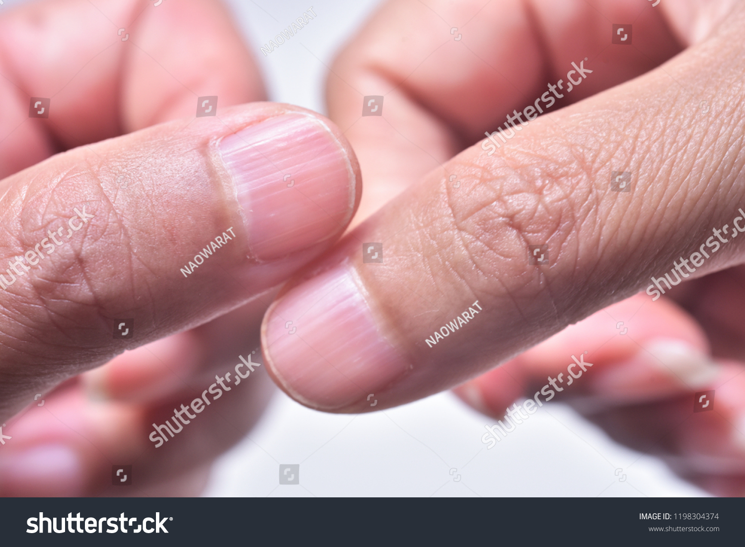 94 Vertical lines fingernails Images, Stock Photos & Vectors Shutterstock