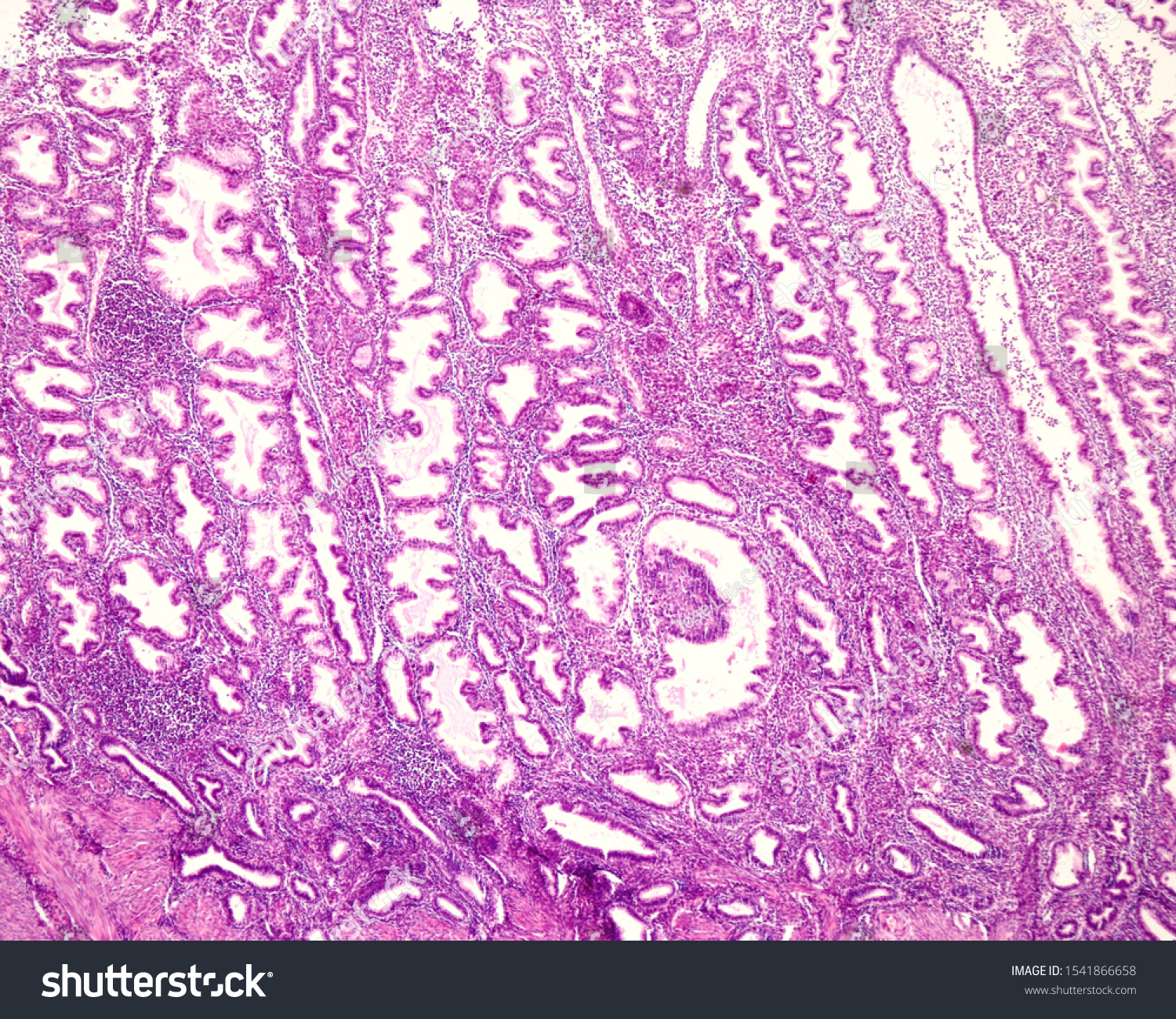 Histology secretory endometrium Hormonal Pathology