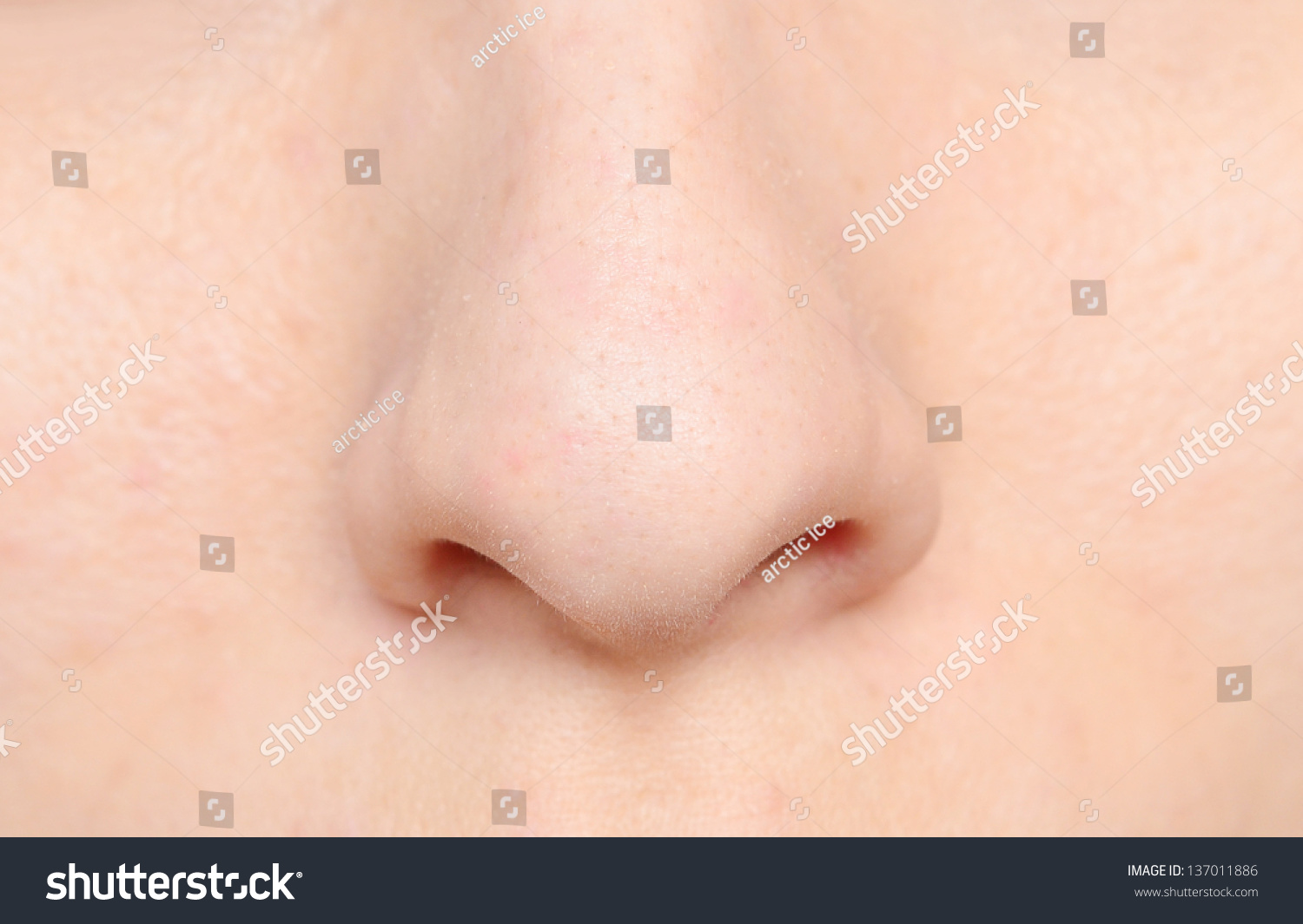 red-spot-on-nose-acne-cancer-and-other-causes