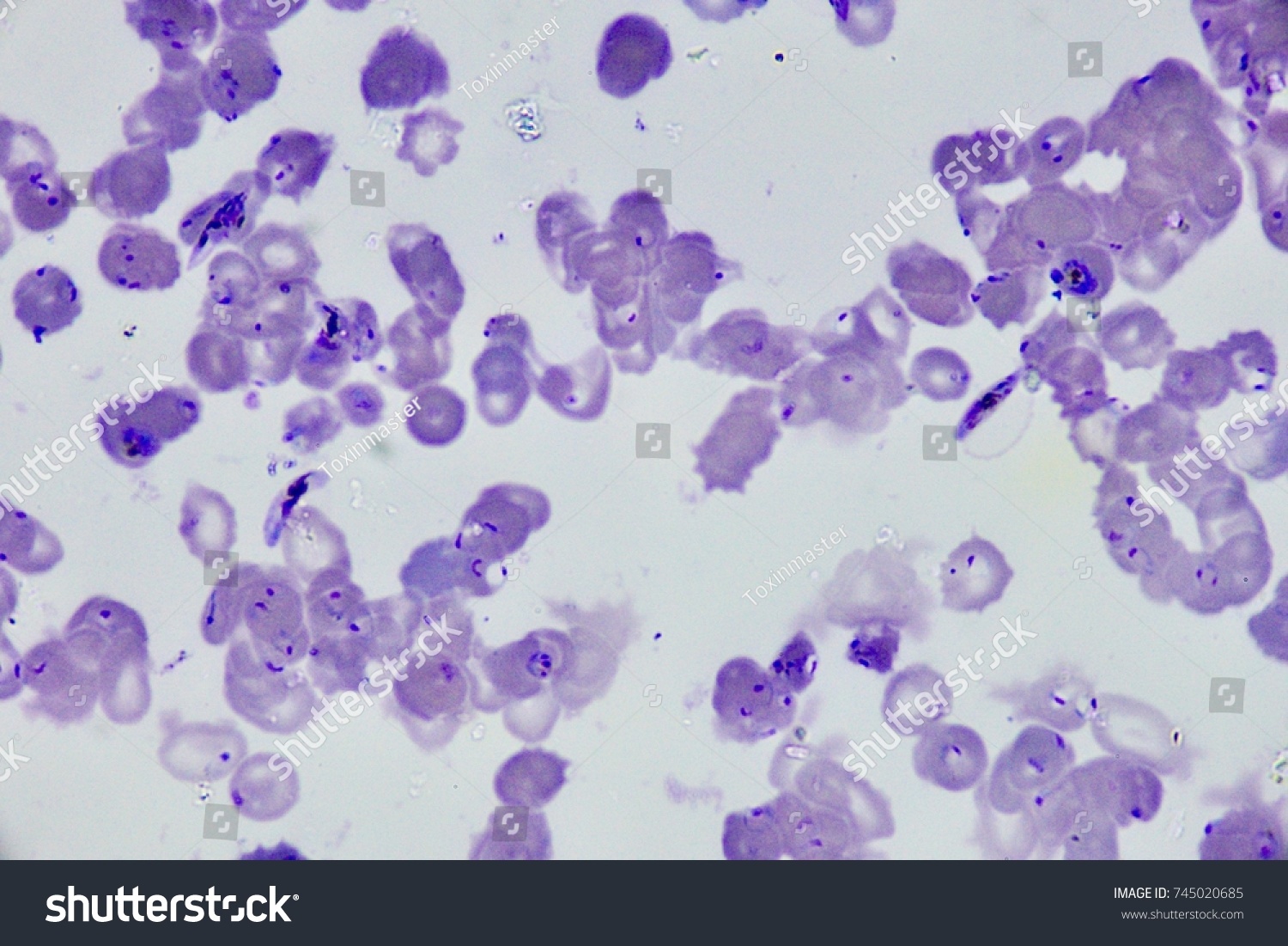 Malaria Plasmodium Falciparum Stock Photo (Edit Now) 745020685