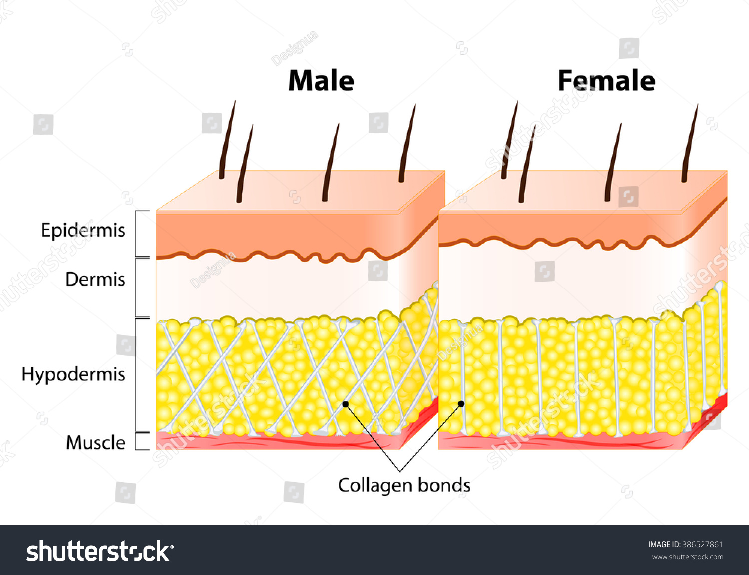 男性と女性の皮膚 構造と違う 男性の表皮は女性の表皮よりずっと厚い のイラスト素材