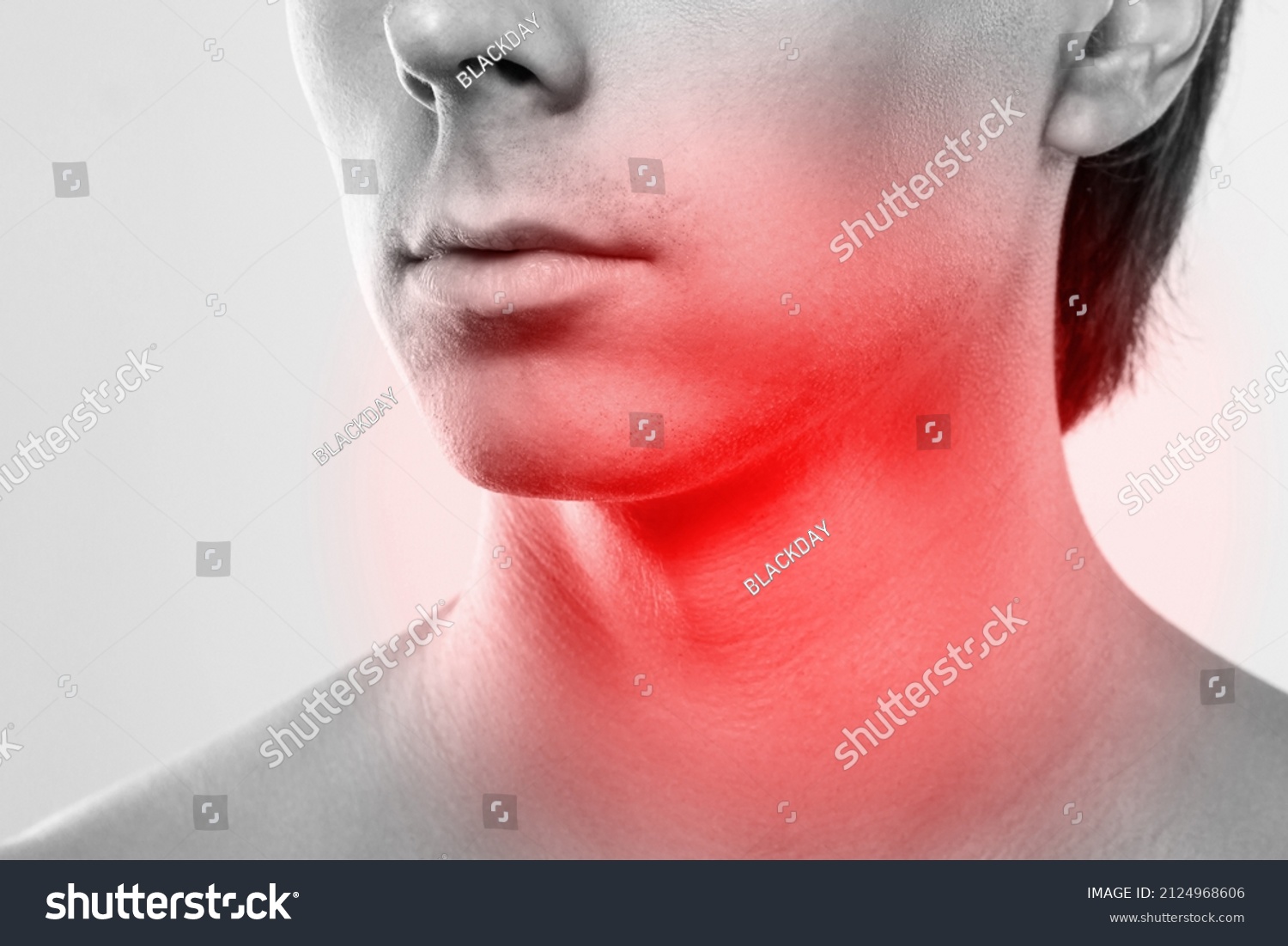 male-face-painful-red-spot-on-stock-photo-2124968606-shutterstock