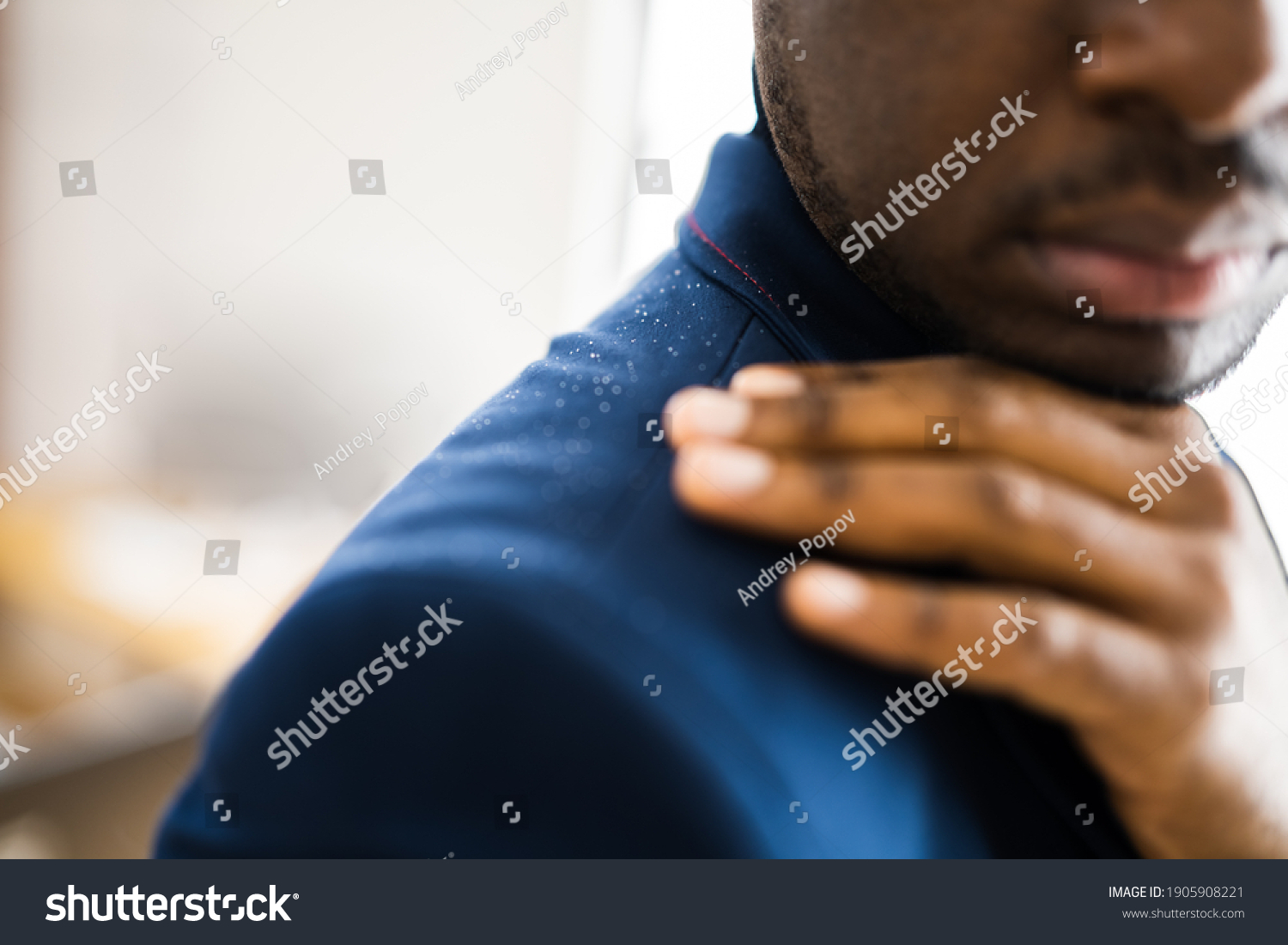 Man Brushing Dandruff Dirty Suit Itchy Foto Stok 1905908221 Shutterstock