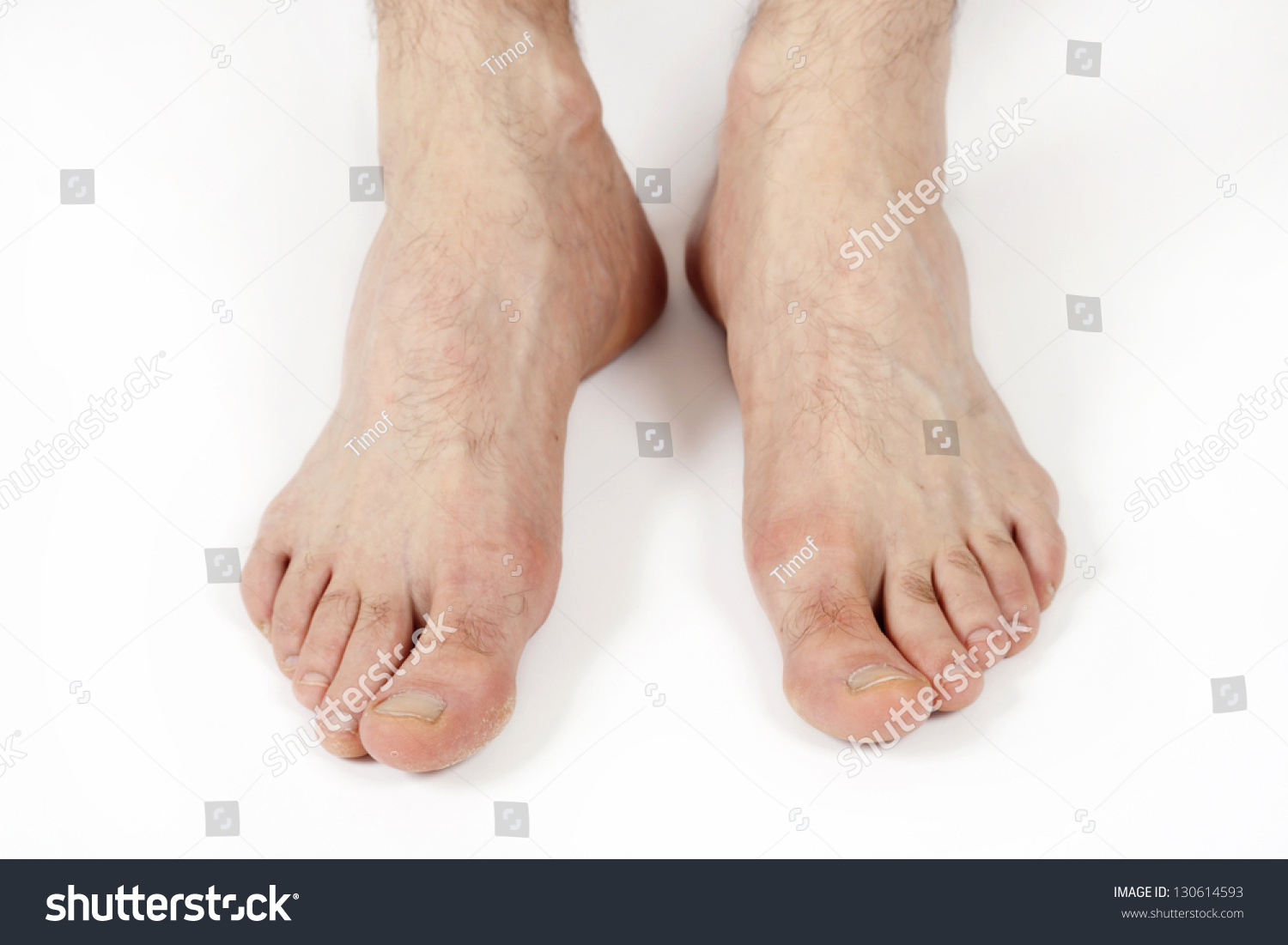 Mans Feet Stock Photo 130614593 - Shutterstock