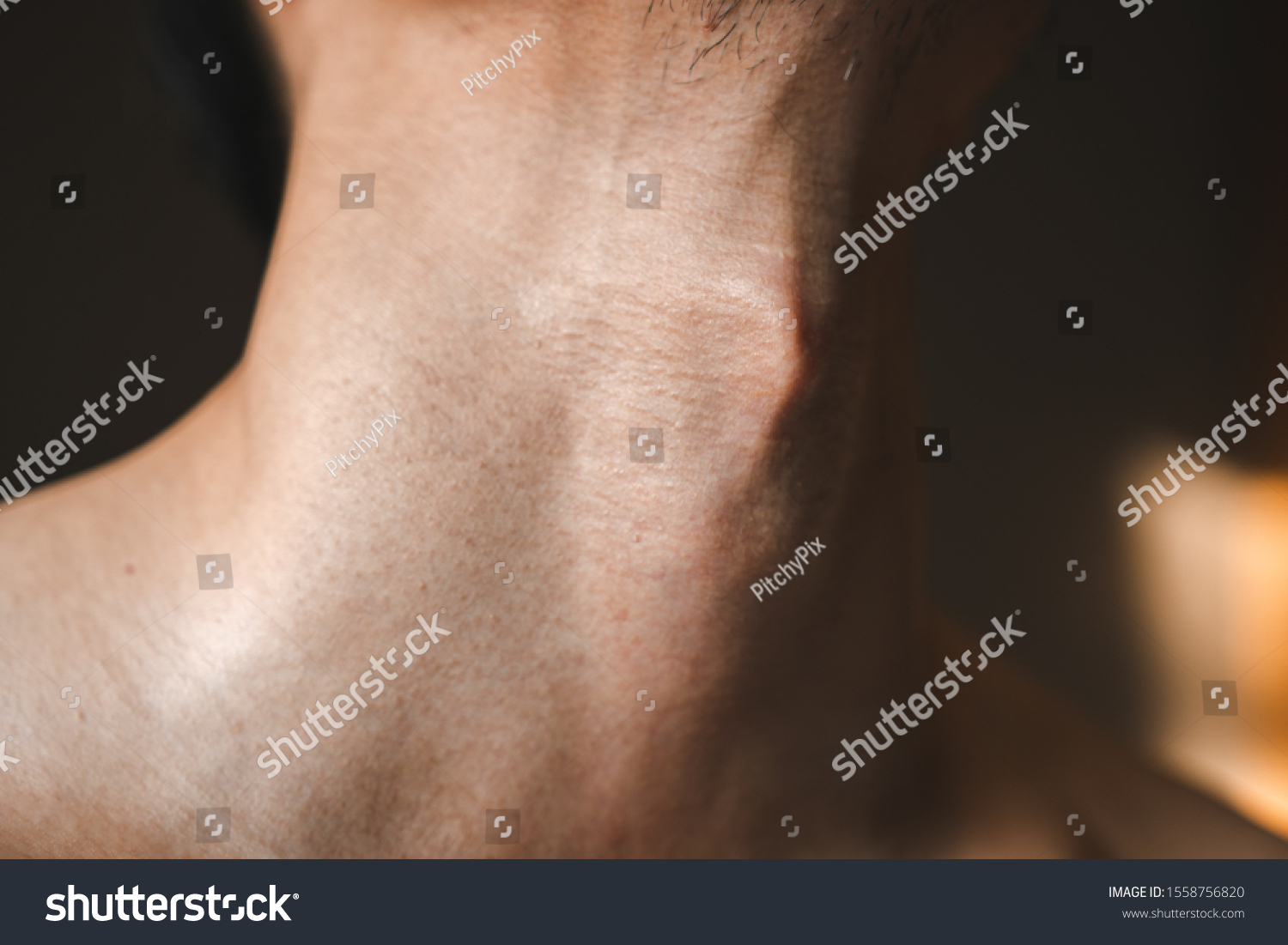 Adam S Apple Images Stock Photos Vectors Shutterstock Adam S Apple Images Stock Photos Vectors Shutterstock