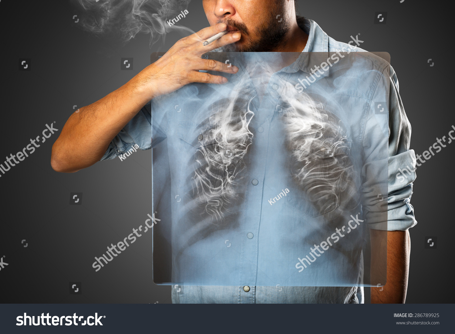 Man Smoking With X-Ray Lung, Isolated On Grey Background Stock Photo ...