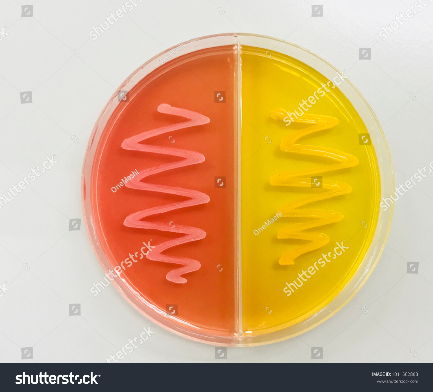 Mannitol Salt Agar Msa 库存照片（立即编辑）1011562888