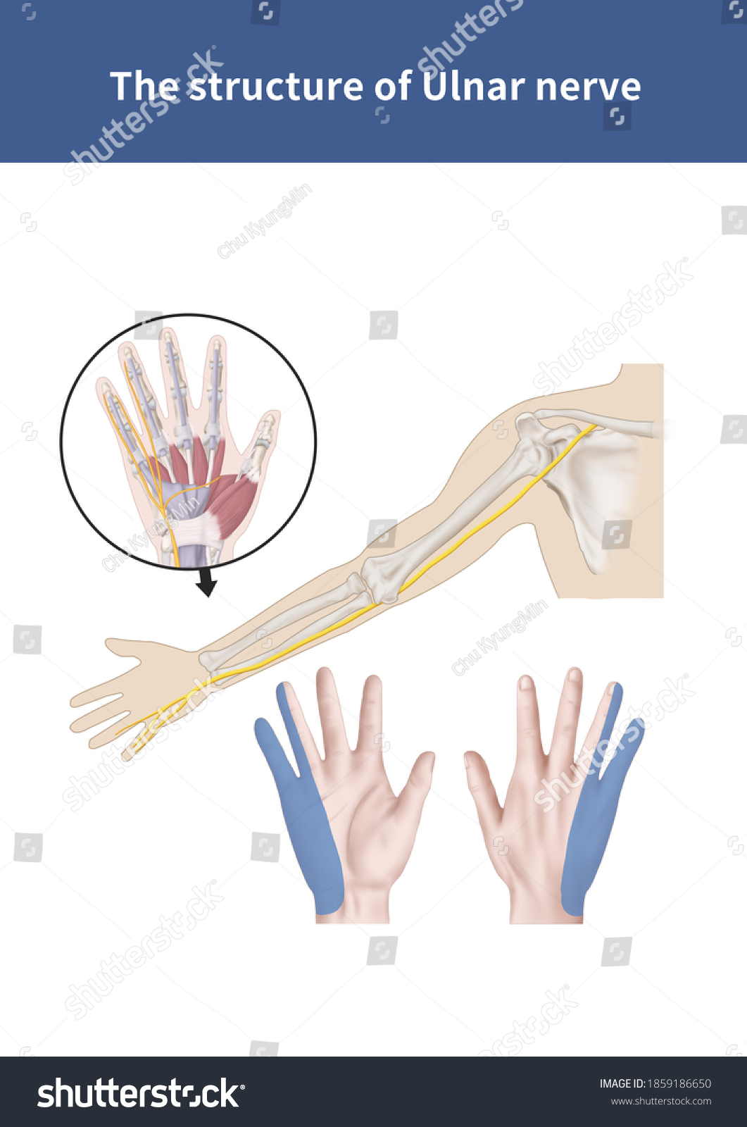 Medical Illustration Explanation Ulnar Nerve Stock Illustration ...