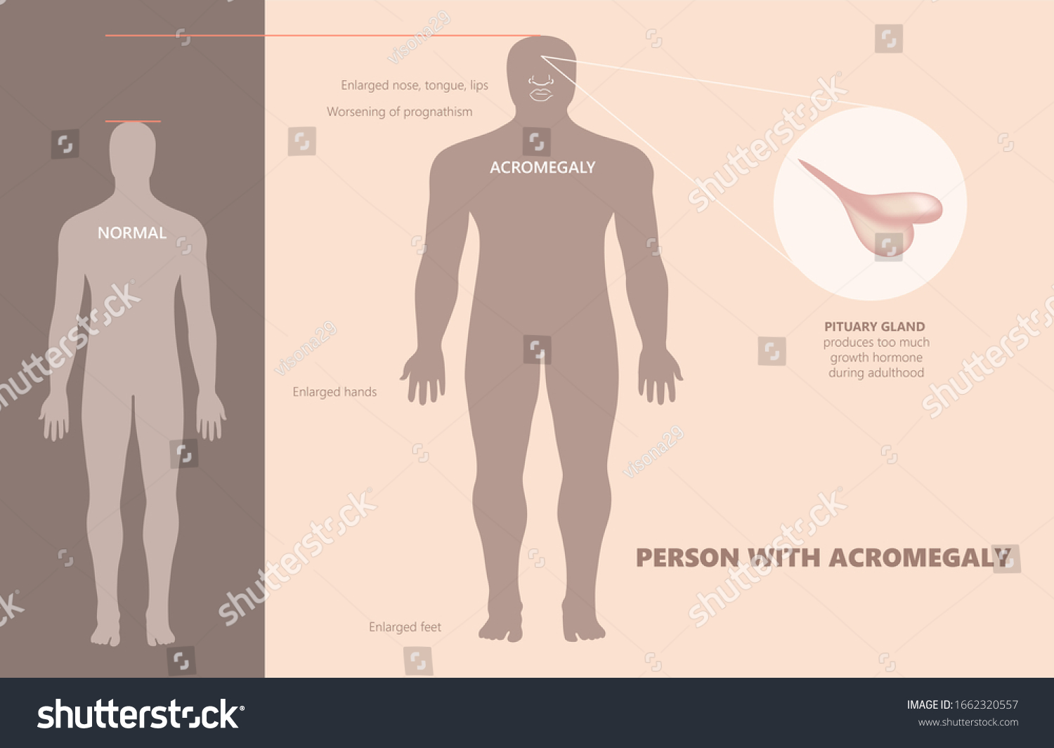 Medical Illustration Pituitary Gland Produces Much Stock Illustration 1662320557 2215