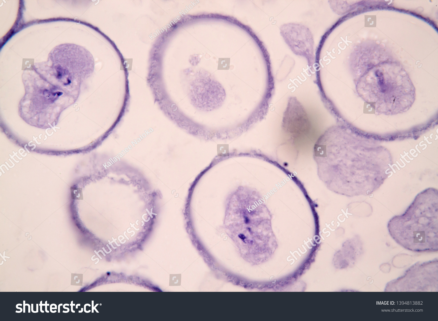 Meiosis Animal Cell Under Microscope Education Stock Photo (Edit Now ...