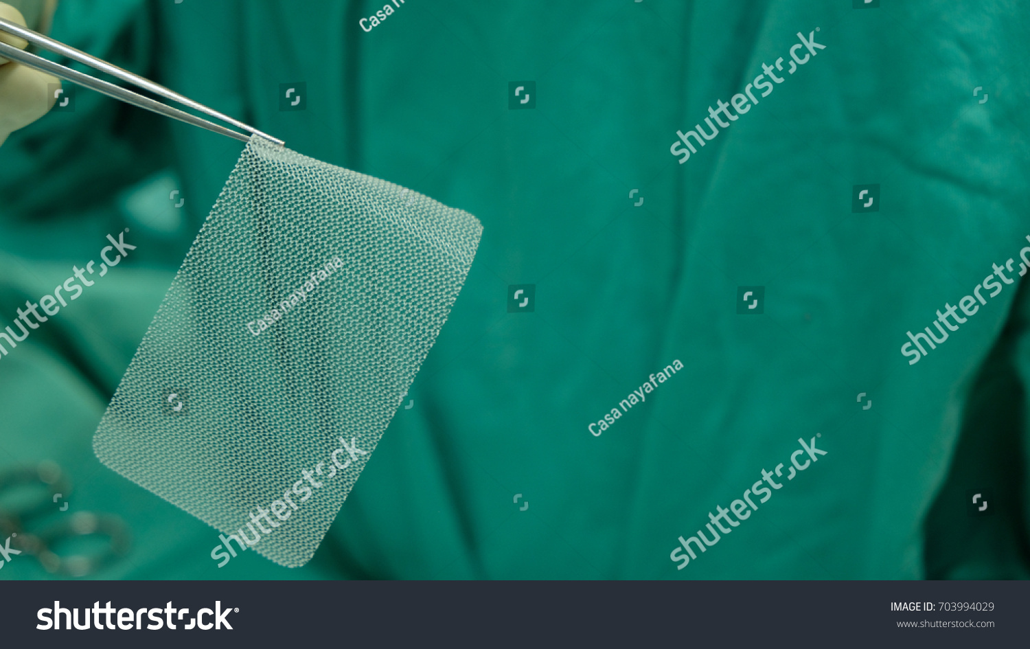 Стоковая фотография 703994029 Mesh Inguinal Hernia Repair Shutterstock