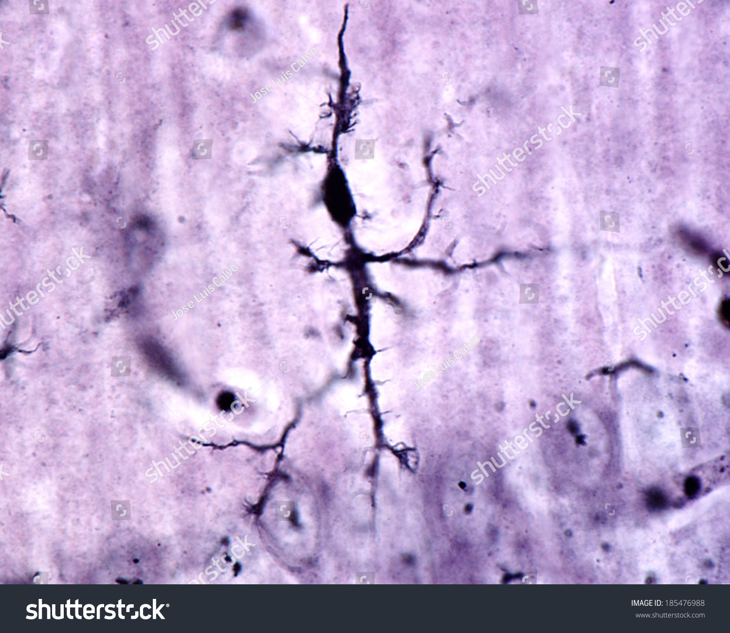 Microglia Cell Stained Rio Hortegas Silver Stock Photo 185476988 