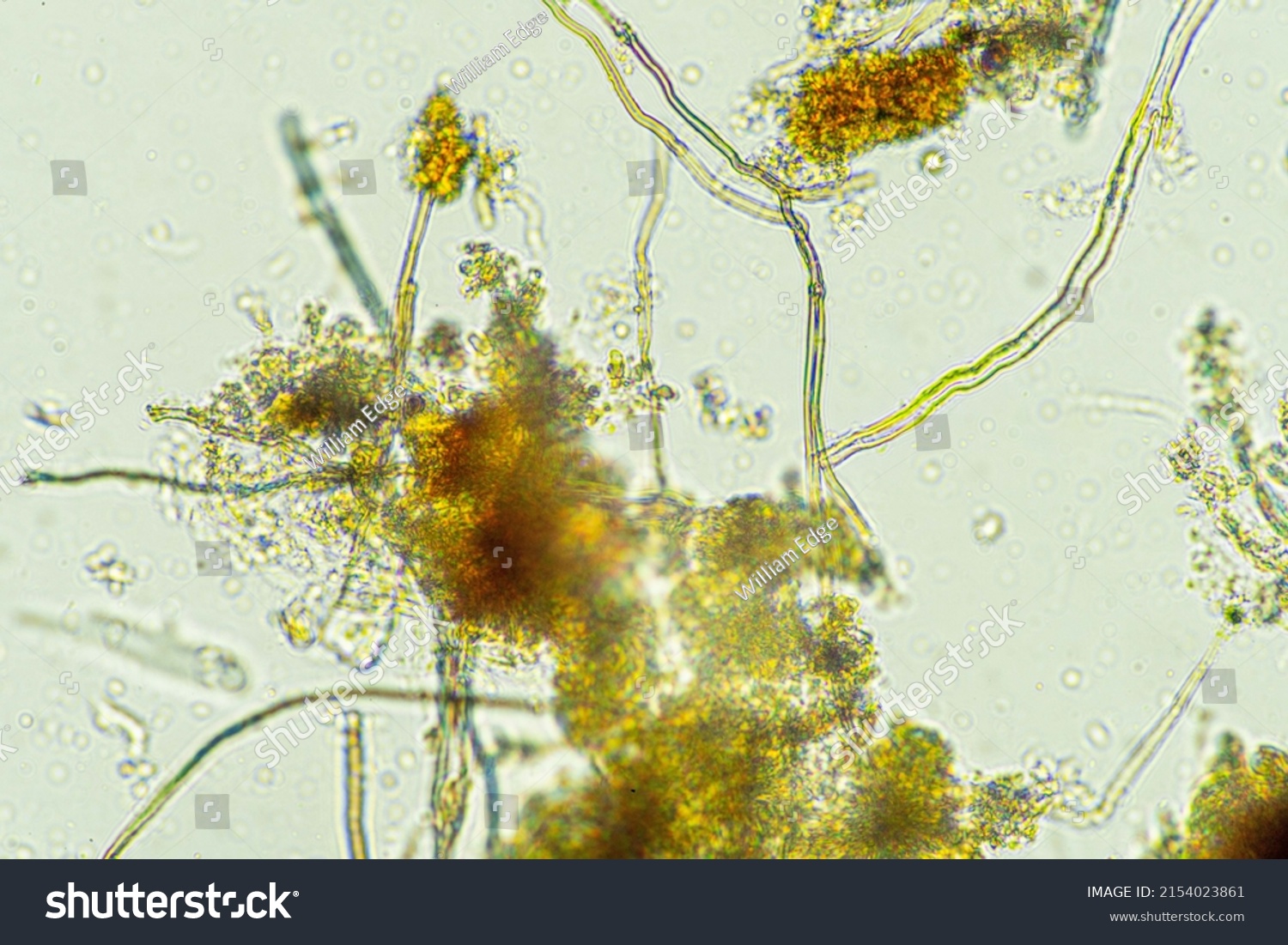 Microorganisms Soil Biology Nematodes Fungi Under Stock Photo ...