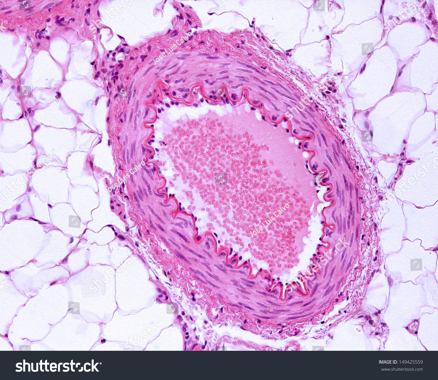 Microscope Image Muscular Artery Stained Hematoxylineosin Stock Photo ...