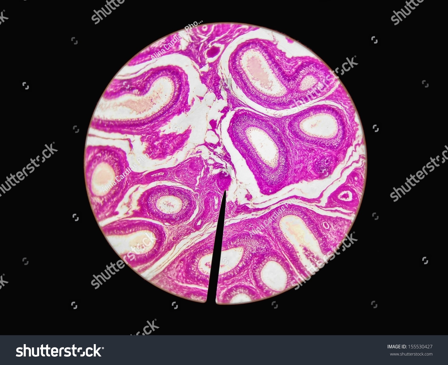 Microscopic Cross Section Testes Testis Ts Foto De Stock Shutterstock