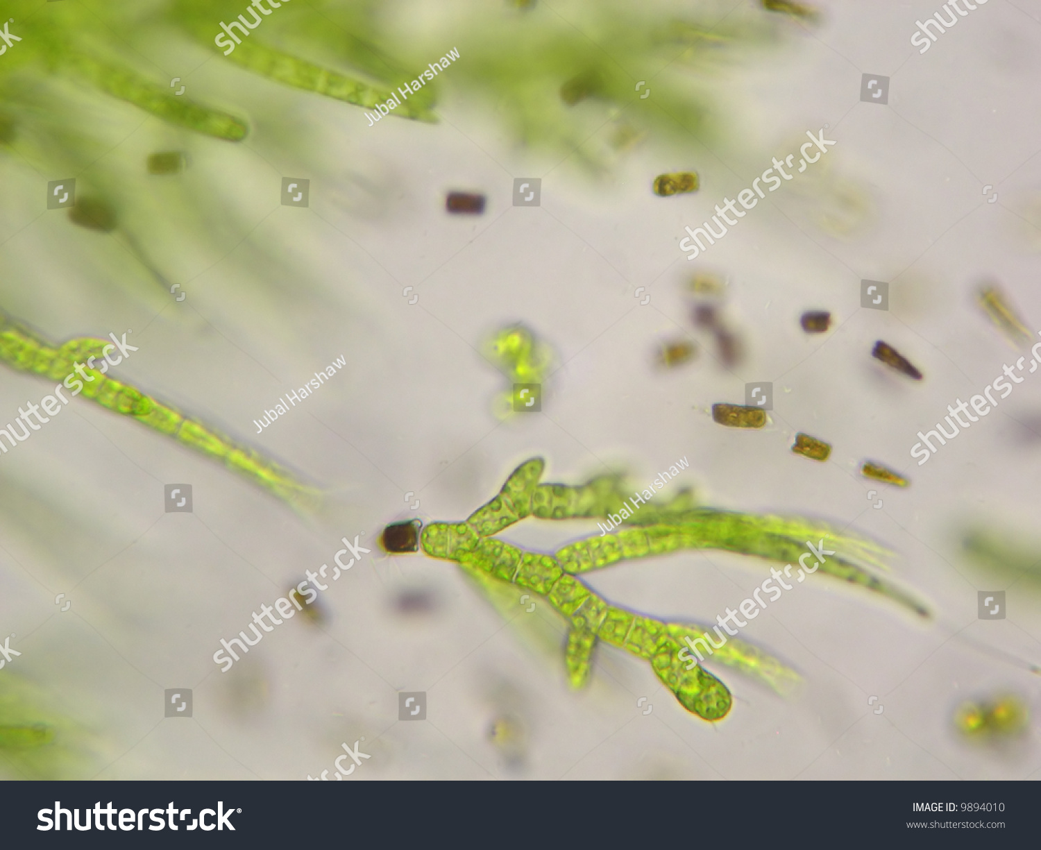 Microscopic Filamentous Algae. Draparnaldia Is Shown As It Arises From ...