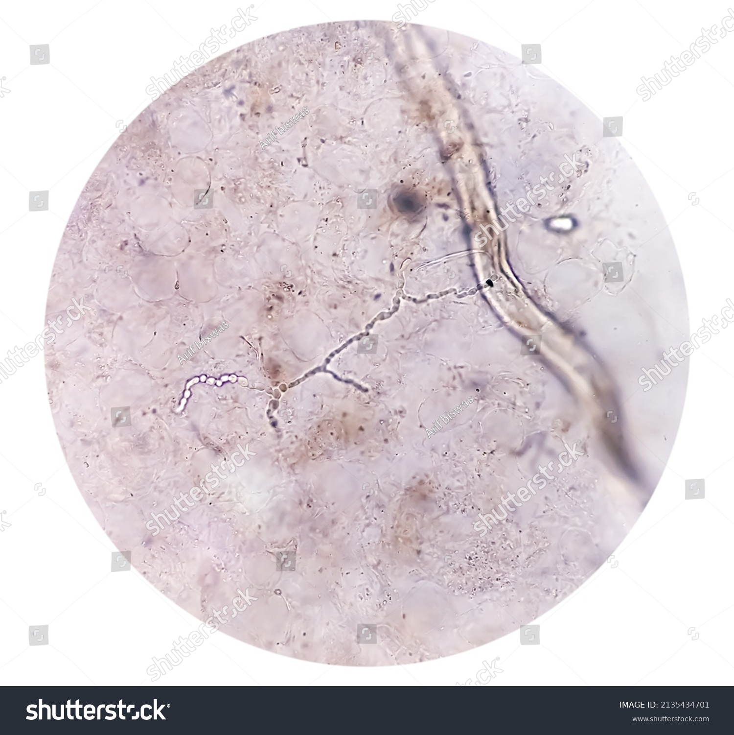 Microscopic Image Dermatophytes Nail Scraping Fungus Stock Photo (Edit ...