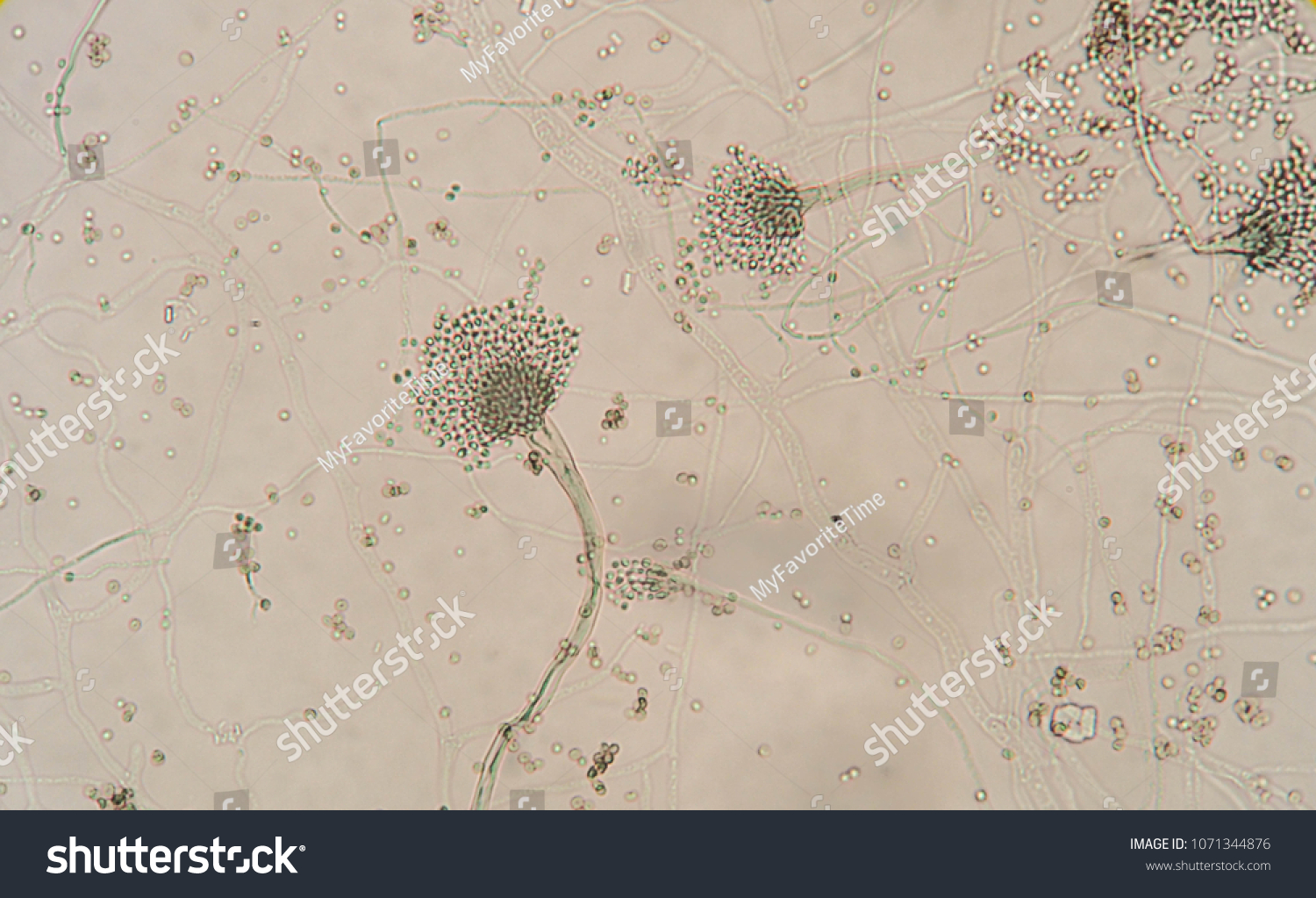 Microscopic Morphology Aspergillus Spp Using Lactophenol Stock Photo ...