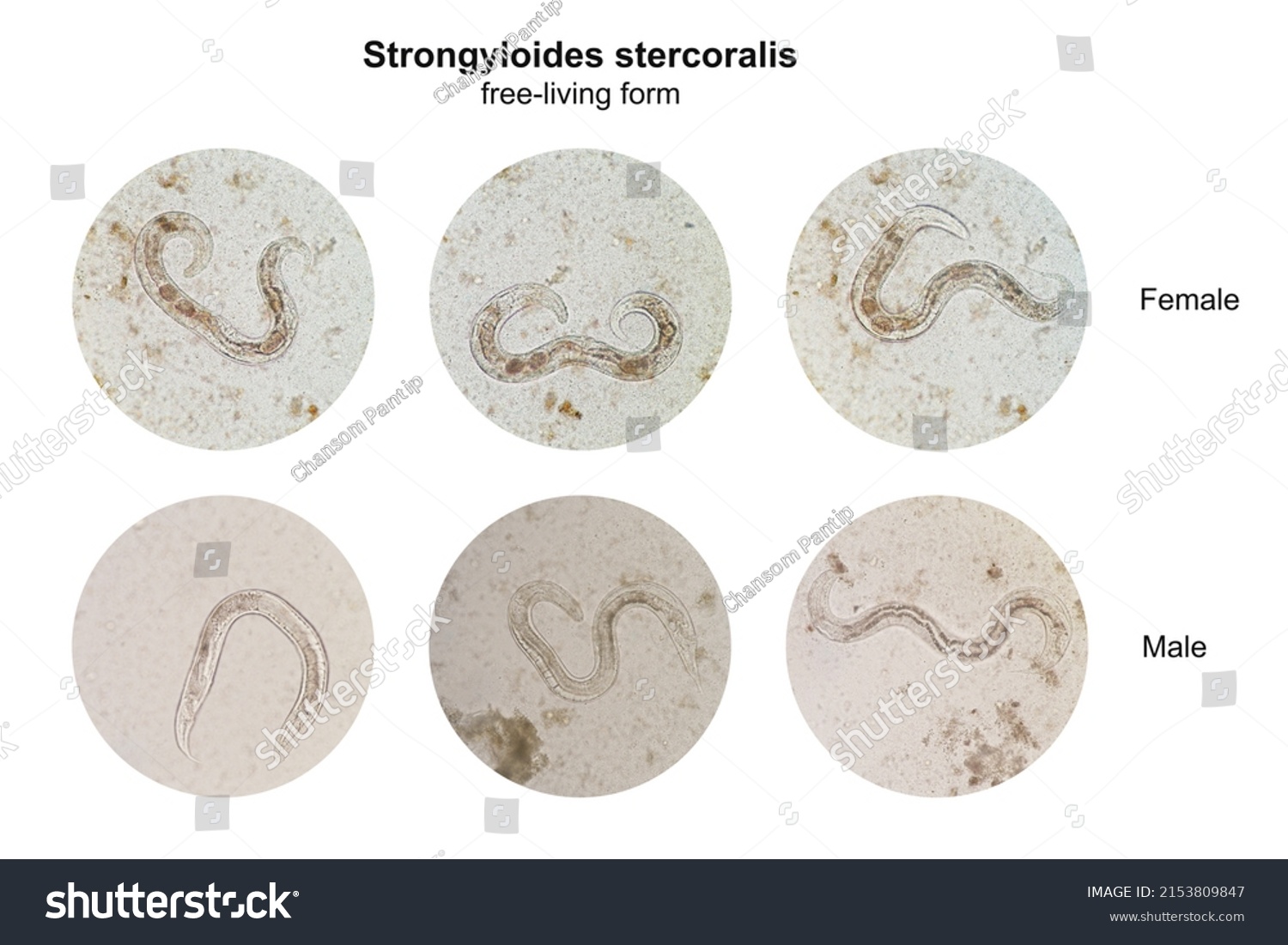 266-strongyloides-stercoralis-images-stock-photos-vectors-shutterstock