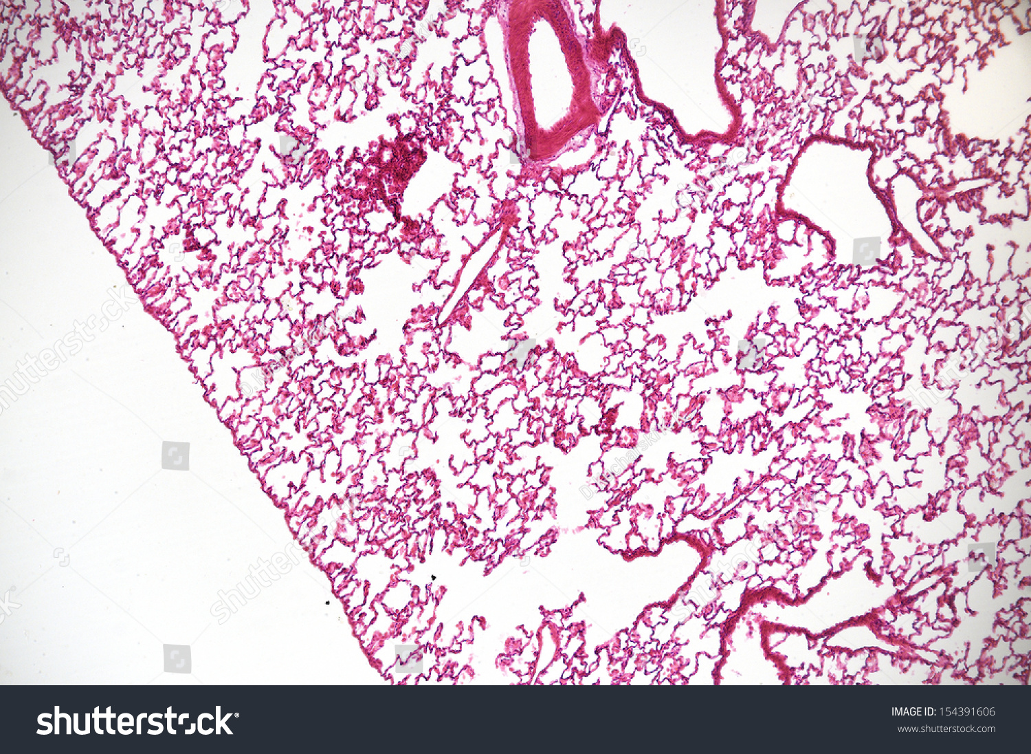 Microscopic View Of Lung Tissue Stock Photo 154391606 : Shutterstock