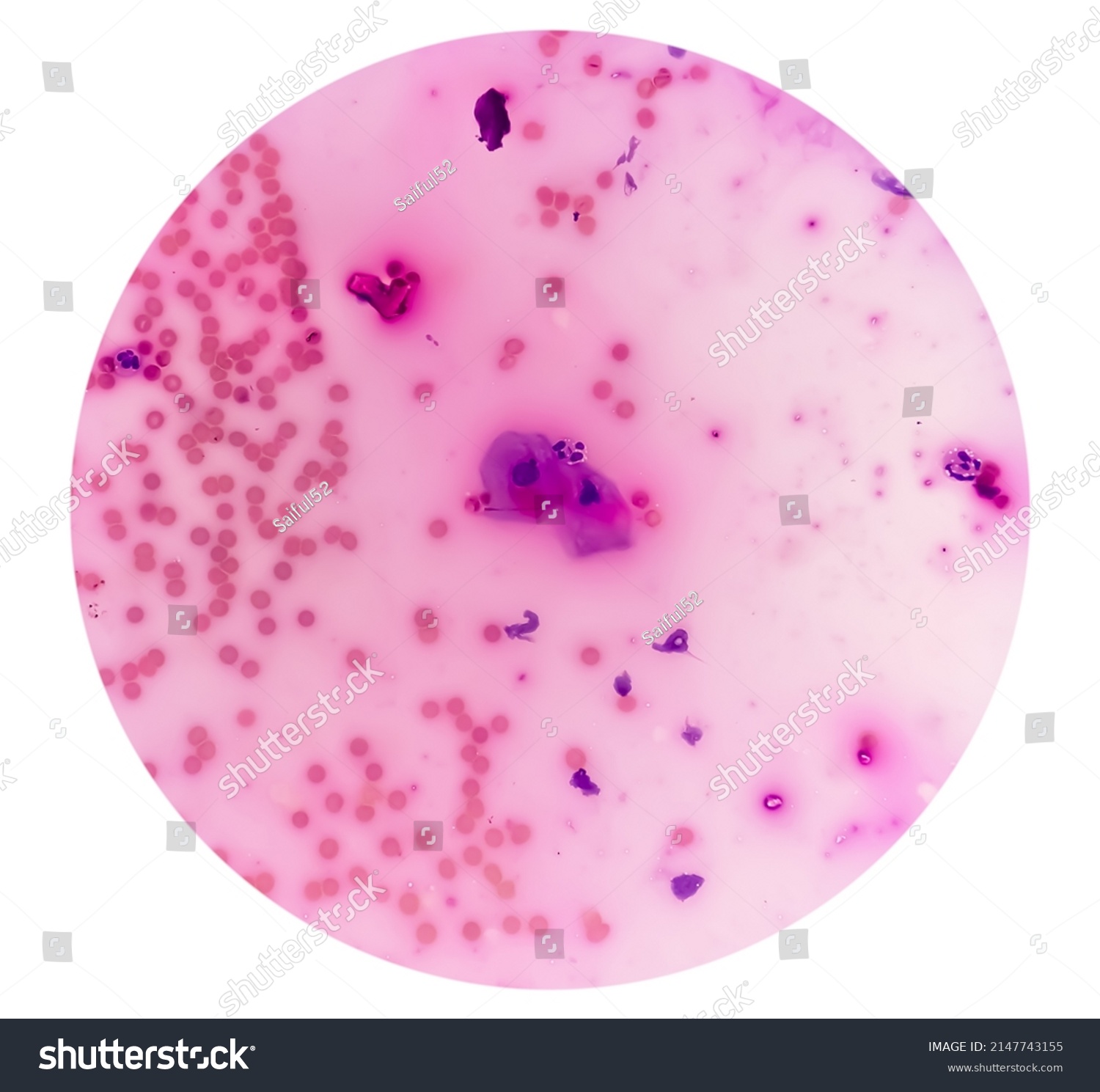 Microscopic View Vault Smear Showing Radiation Stock Photo 2147743155 