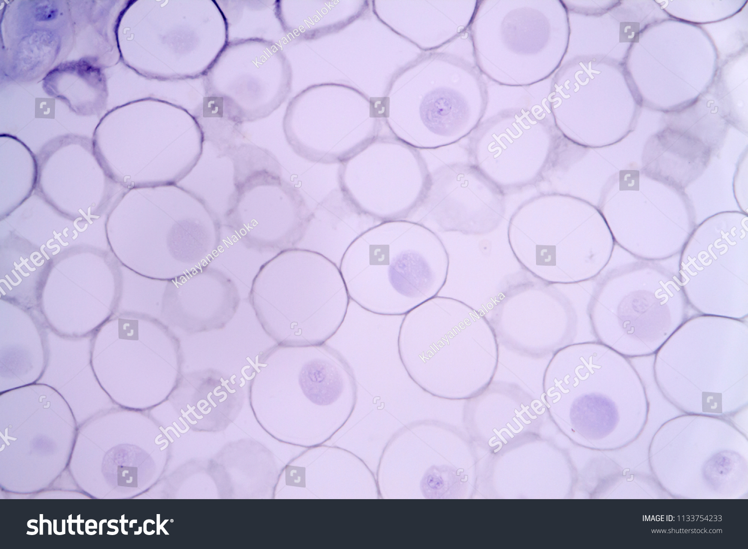 Mitosis Animal Cell Under Microscope Stock Photo Edit Now 1133754233