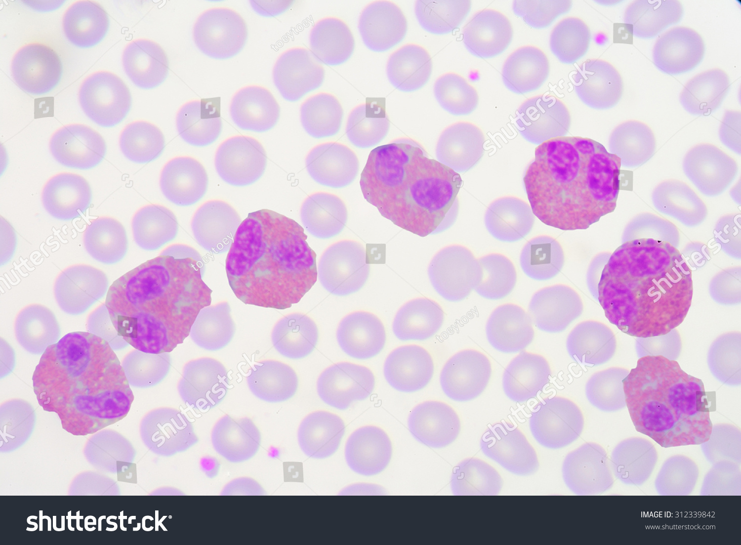 Mix Shape Eosinophils. Blood Smear Is Often Used As A Follow-Up Test To ...