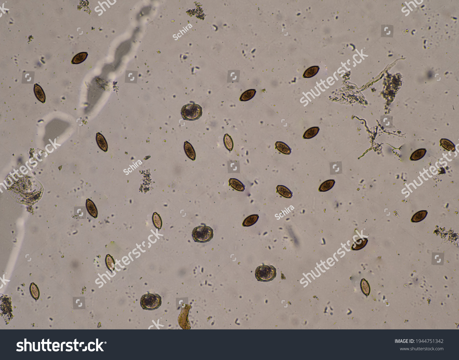 Mixed Ascaris Lumbricoides Trichulis Trichiura Egg Foto Stock 1944751342 Shutterstock 6792