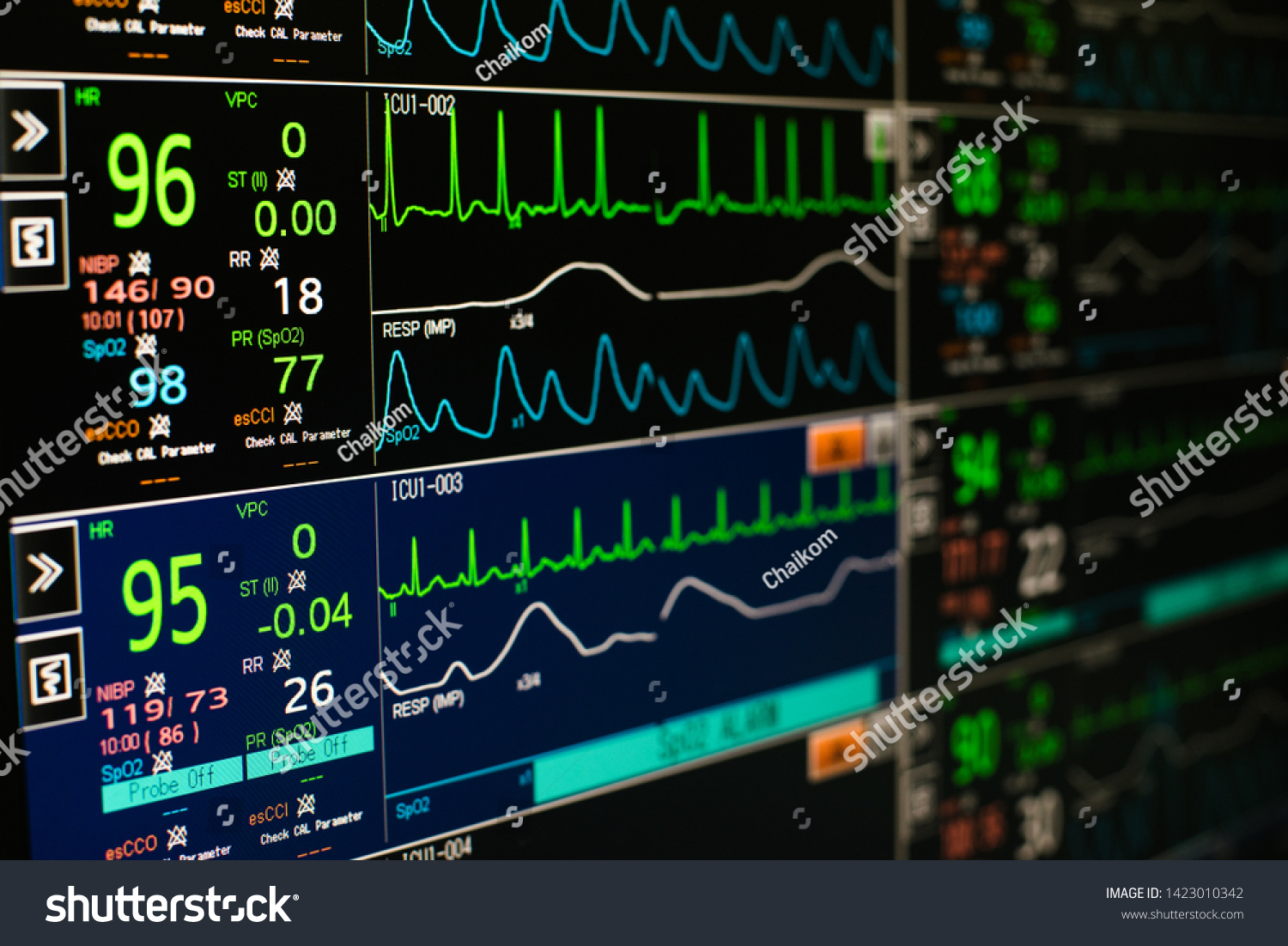 Modern Vital Signs Monitor Display Icu Stock Photo (Edit Now) 1423010342