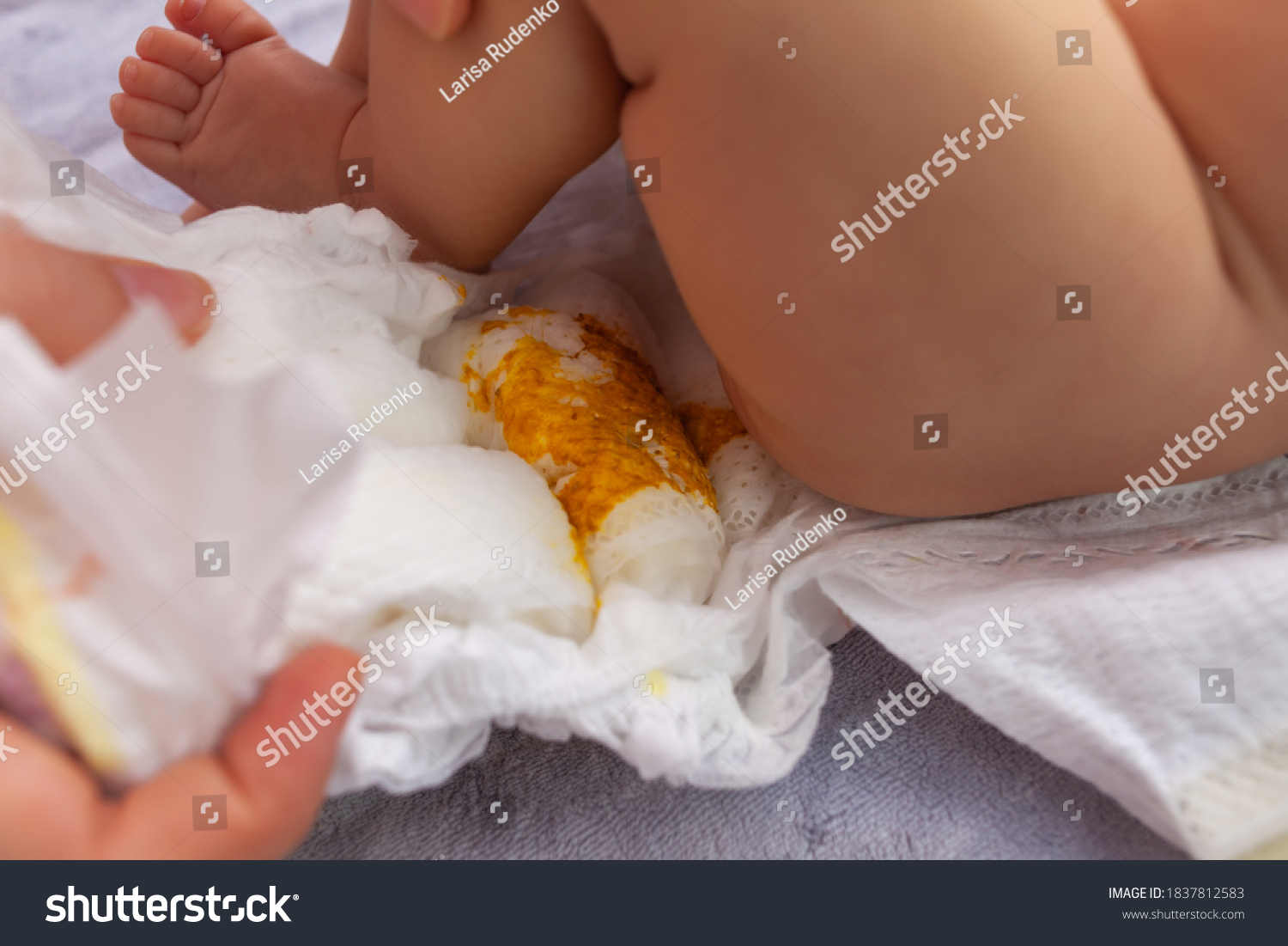 Girl Diaper Poop